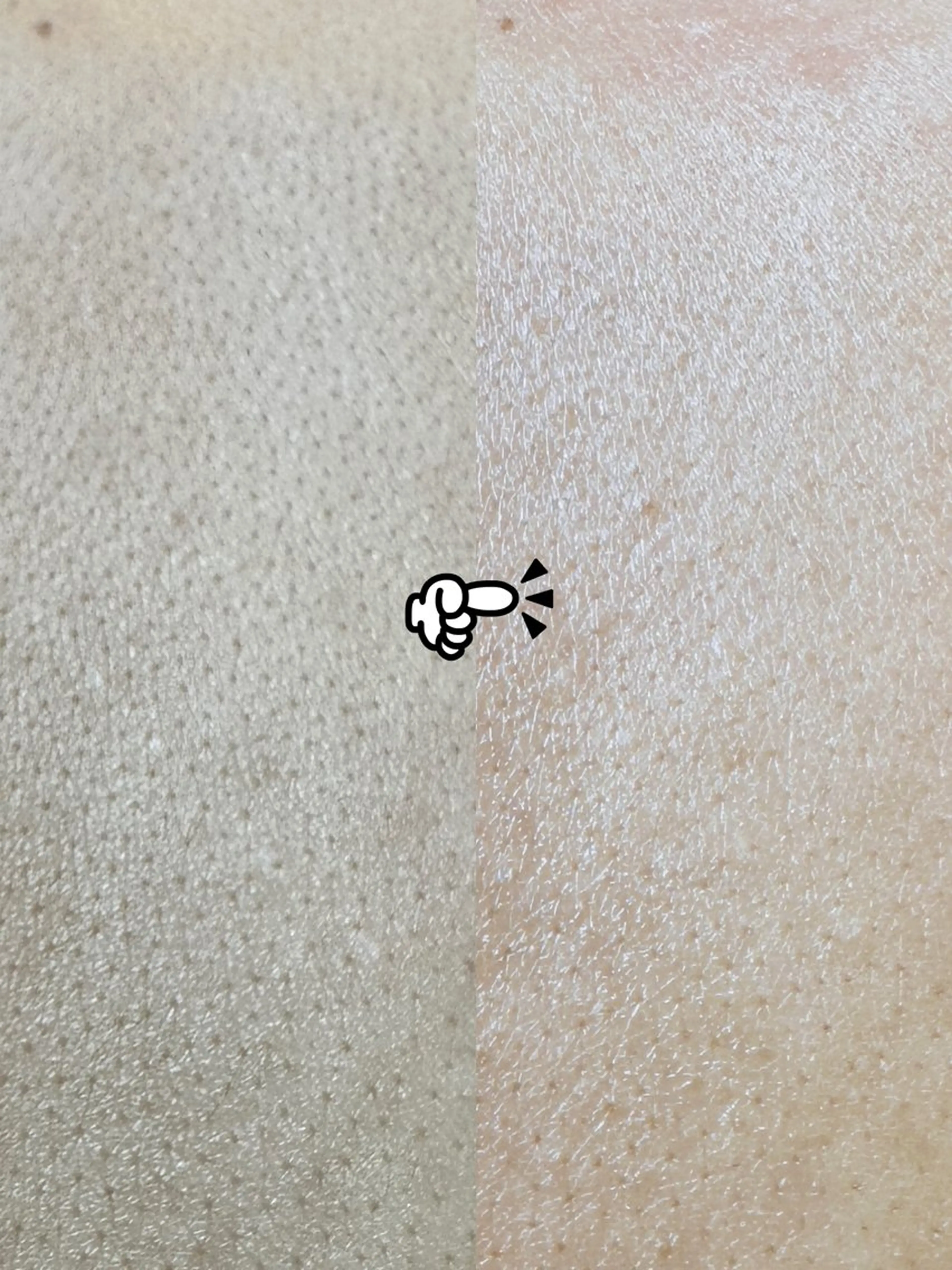 Hit. シュガーリング豊橋のエステ・リラクイメージ