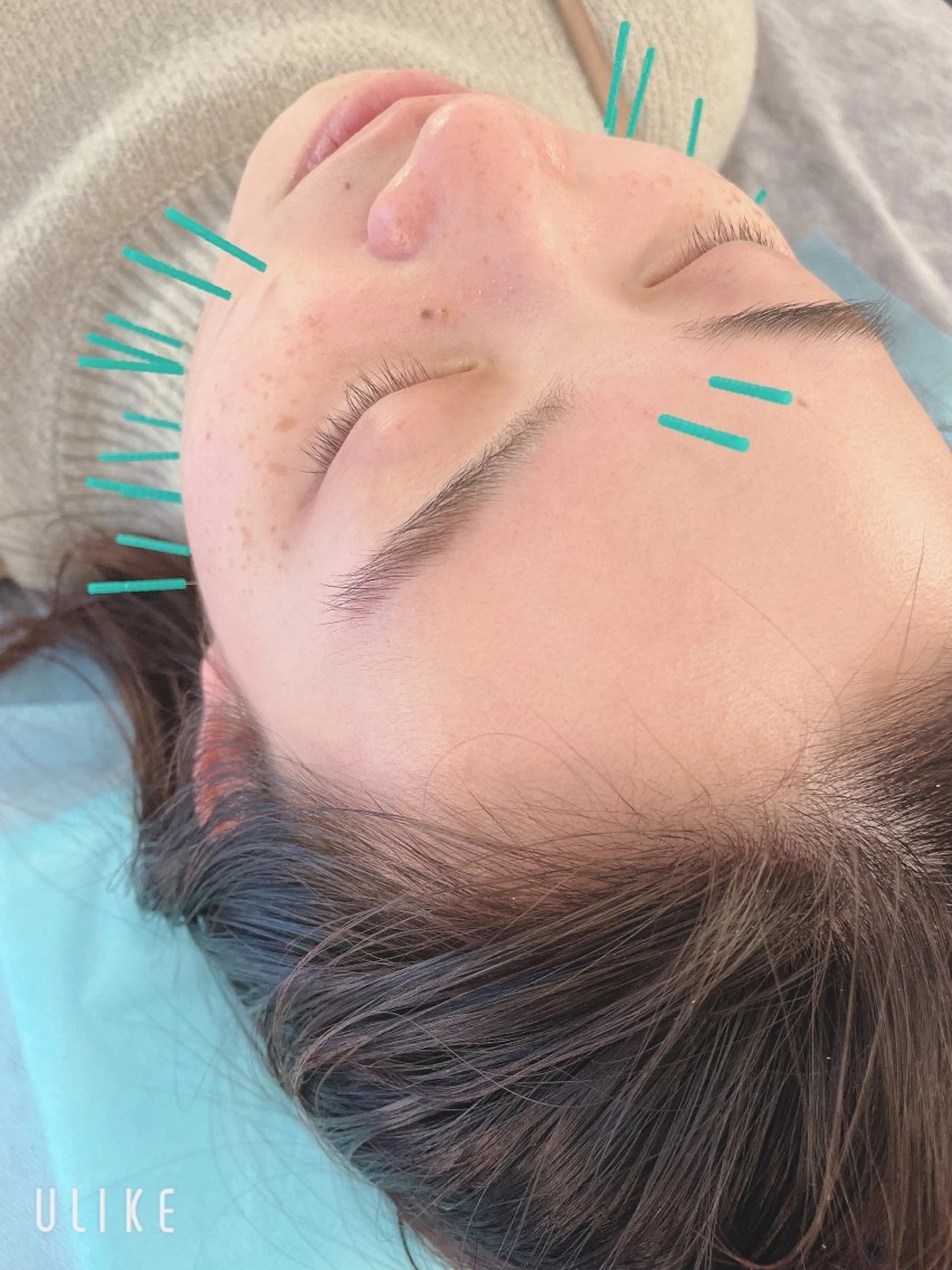 エステ リラク 小顔美容鍼専門サロン 渋谷YZのその他イメージ