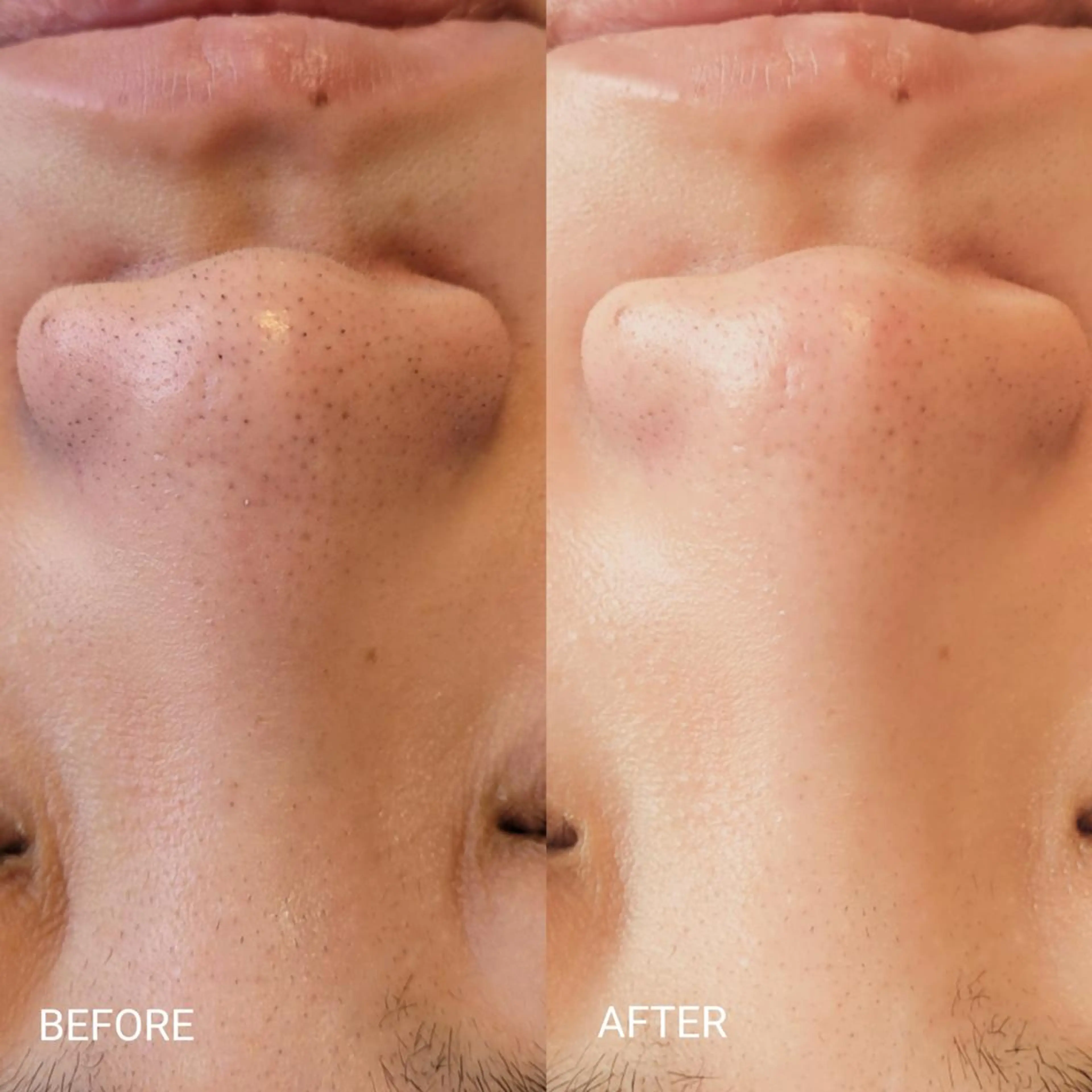 エステ リラク サロンドフララ 表参道店のエステ・リラクイメージ