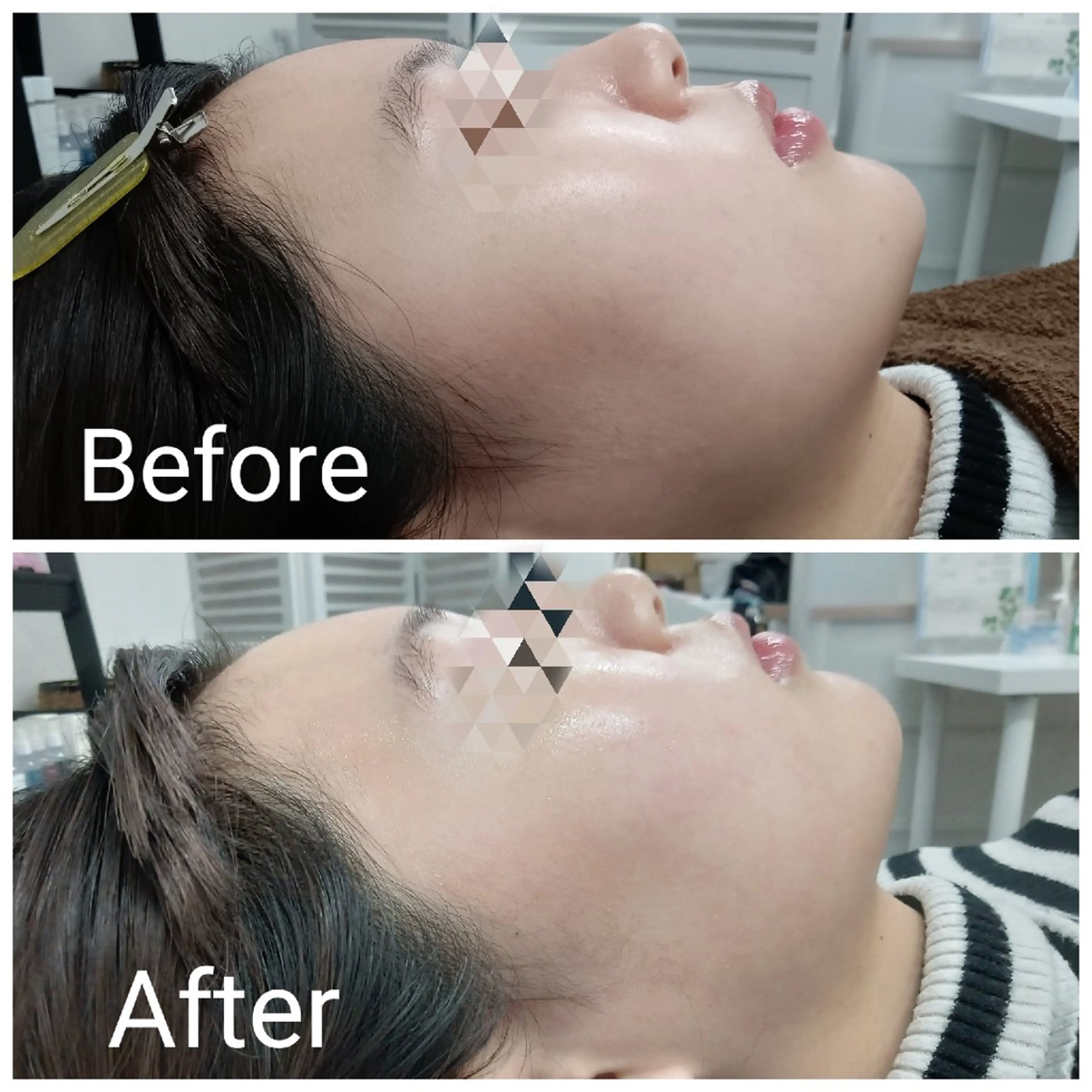 エステ 肌質改善Beauty salon Renのエステ・リラクイメージ