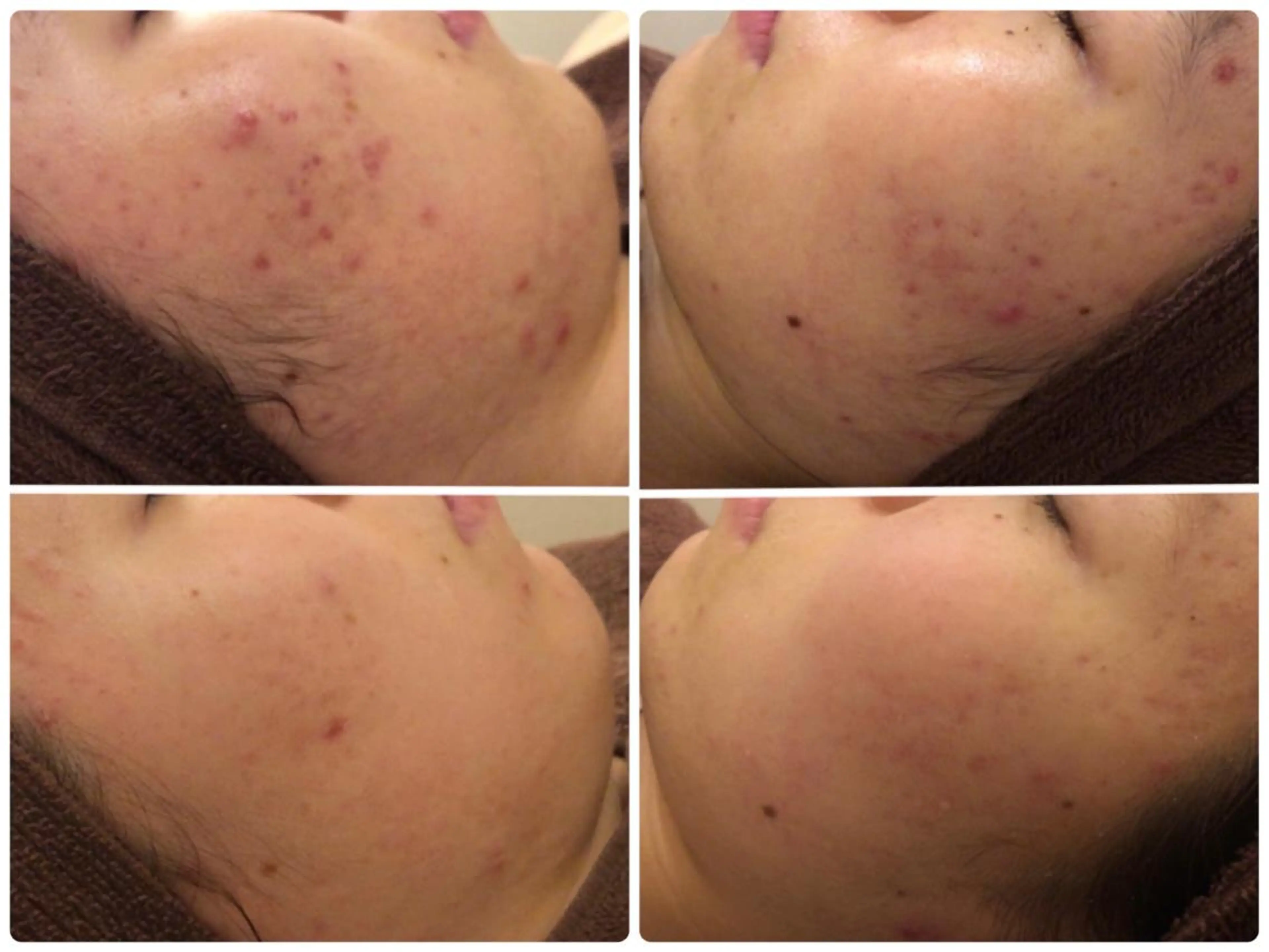 ミディアム カラー パーマ ヘアアレンジ メンズ キッズ ネイル マツエク・マツパ エステ リラク ニキビ・肌質改善専門 ♡人生が変わるサロンのエステ・リラクイメージ