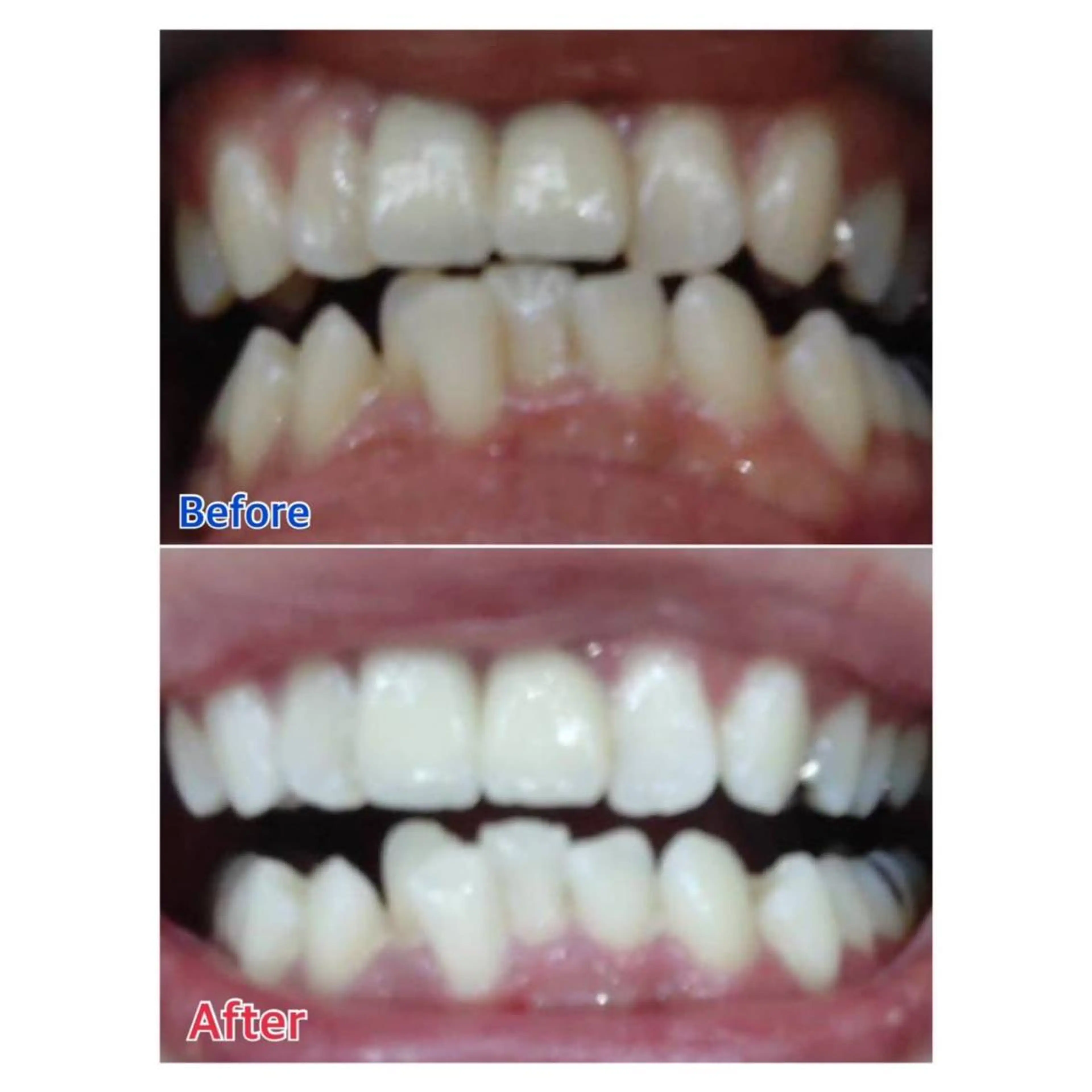 MBEAUTYSALON 千葉店・京成大久保所属・Melty 輝のその他イメージ