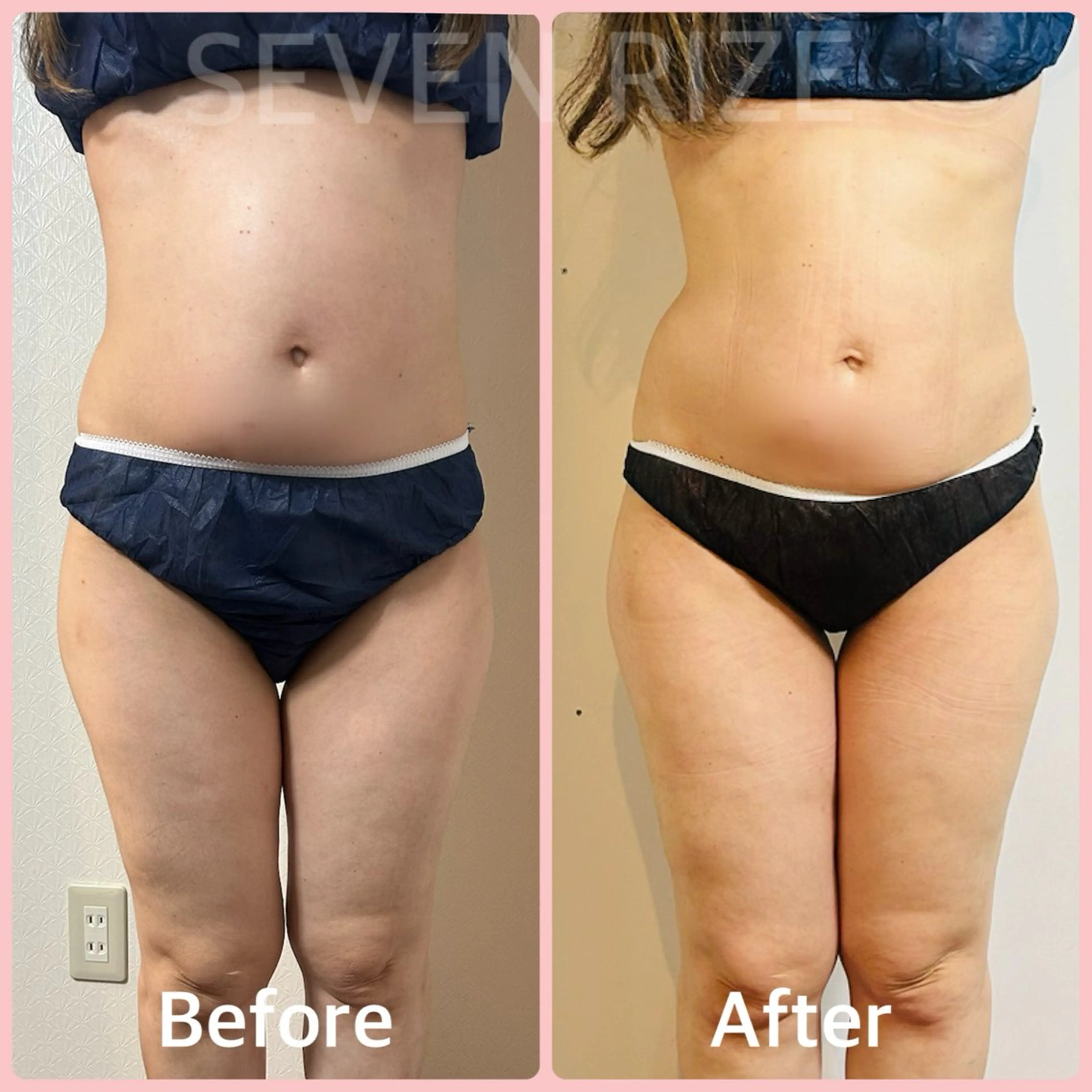 SevenRoom 玉置のエステ・リラクイメージ