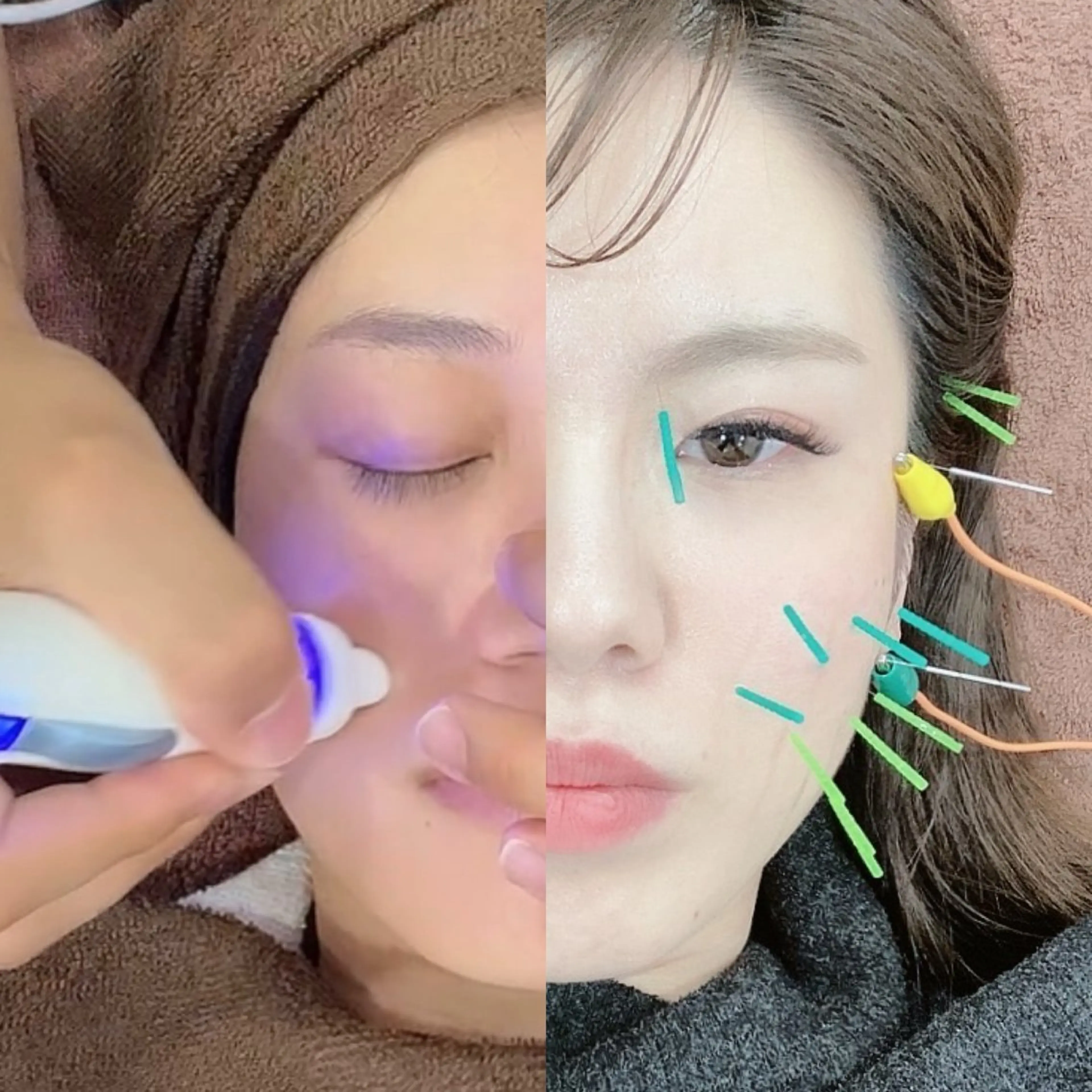 美容鍼×小顔×姿勢× ブライダル整体のエステ・リラクイメージ