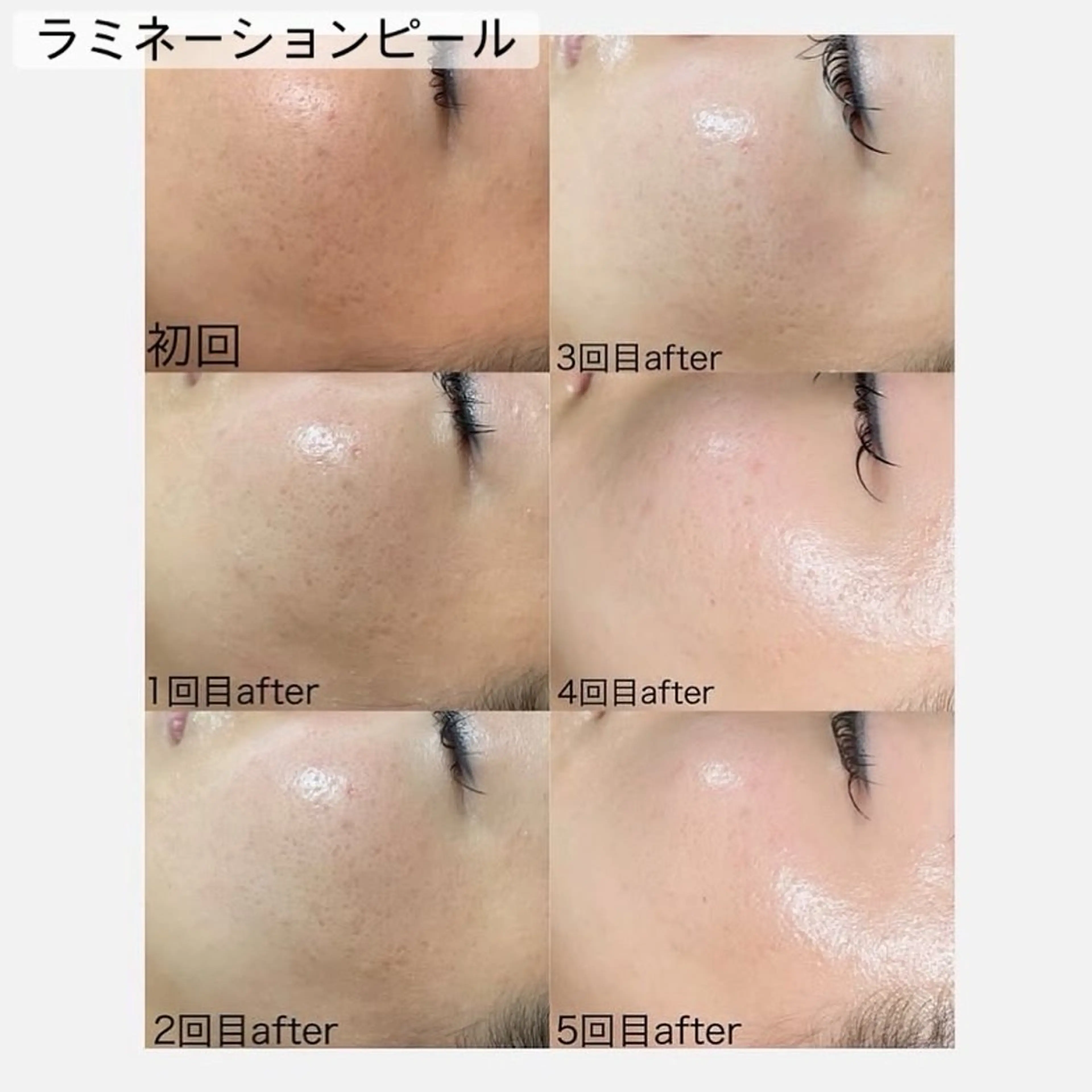 エステ リラク 美白/韓国肌管理 💎 KOTOMIのエステ・リラクイメージ