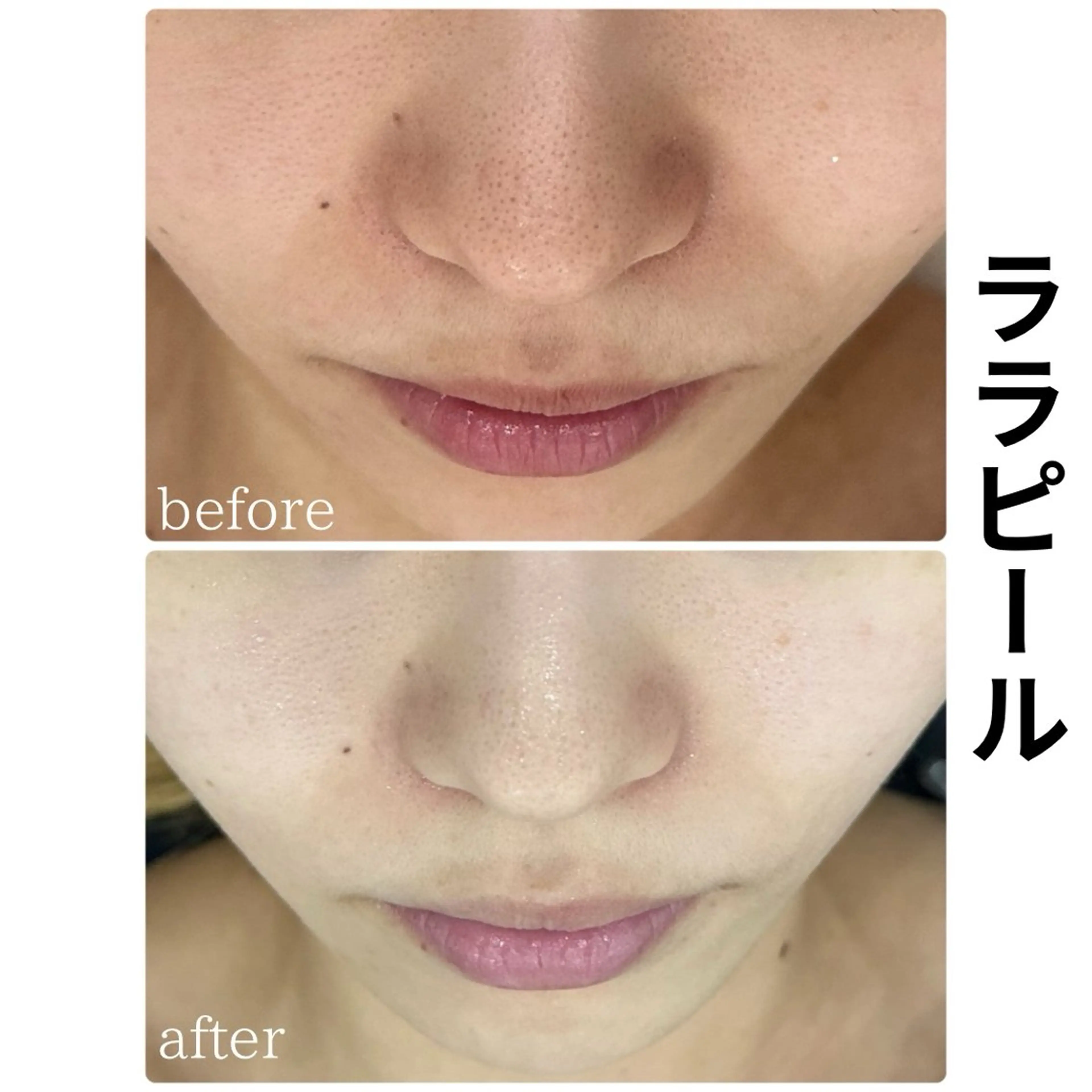 ULT ultimateskin所属・ULT ウルトのエステ・リラクイメージ