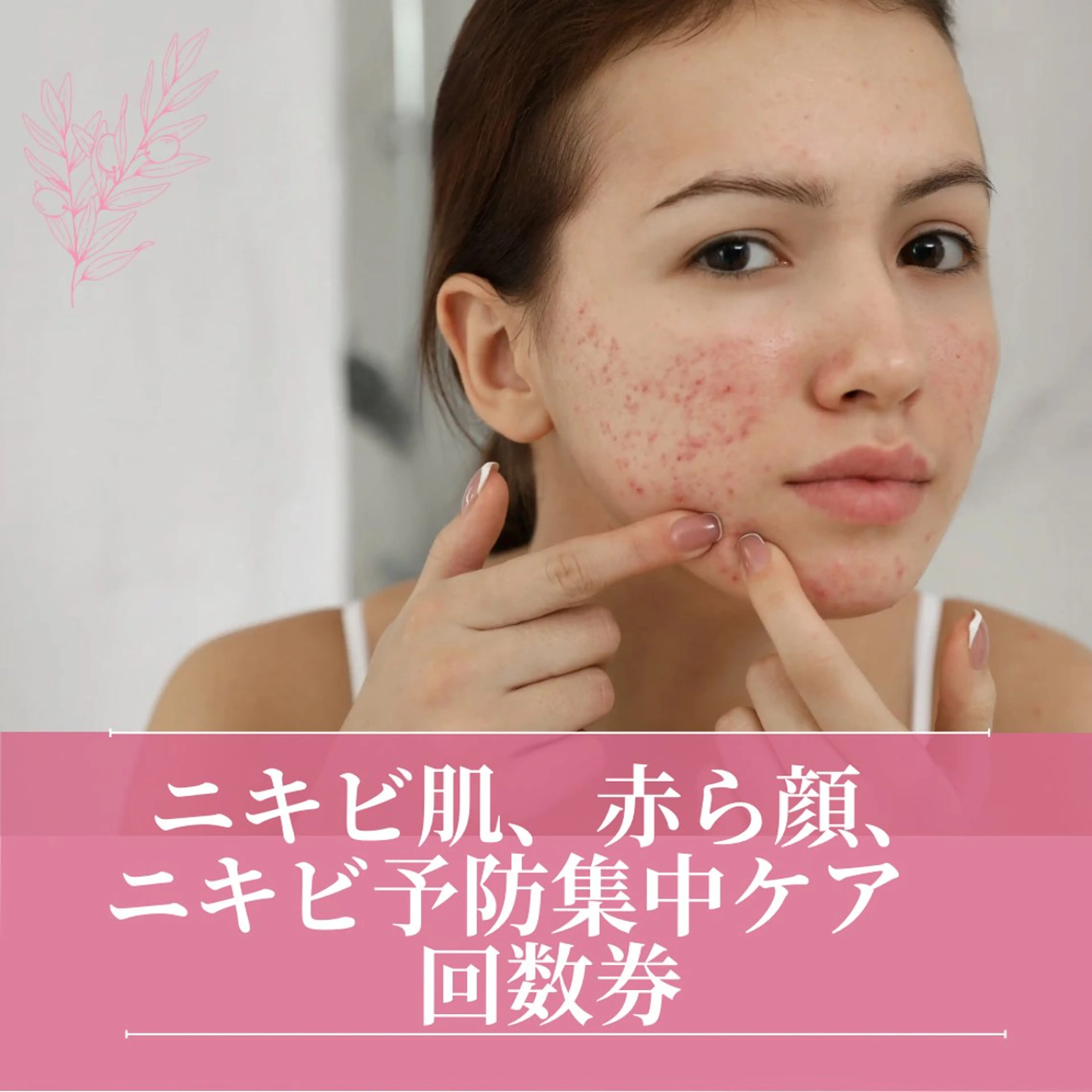 【回数券】各種ニキビ。肌あれ•ニキビ跡•敏感肌•赤ら顔•肌トラブル根本集中ケアコース70分の写真
