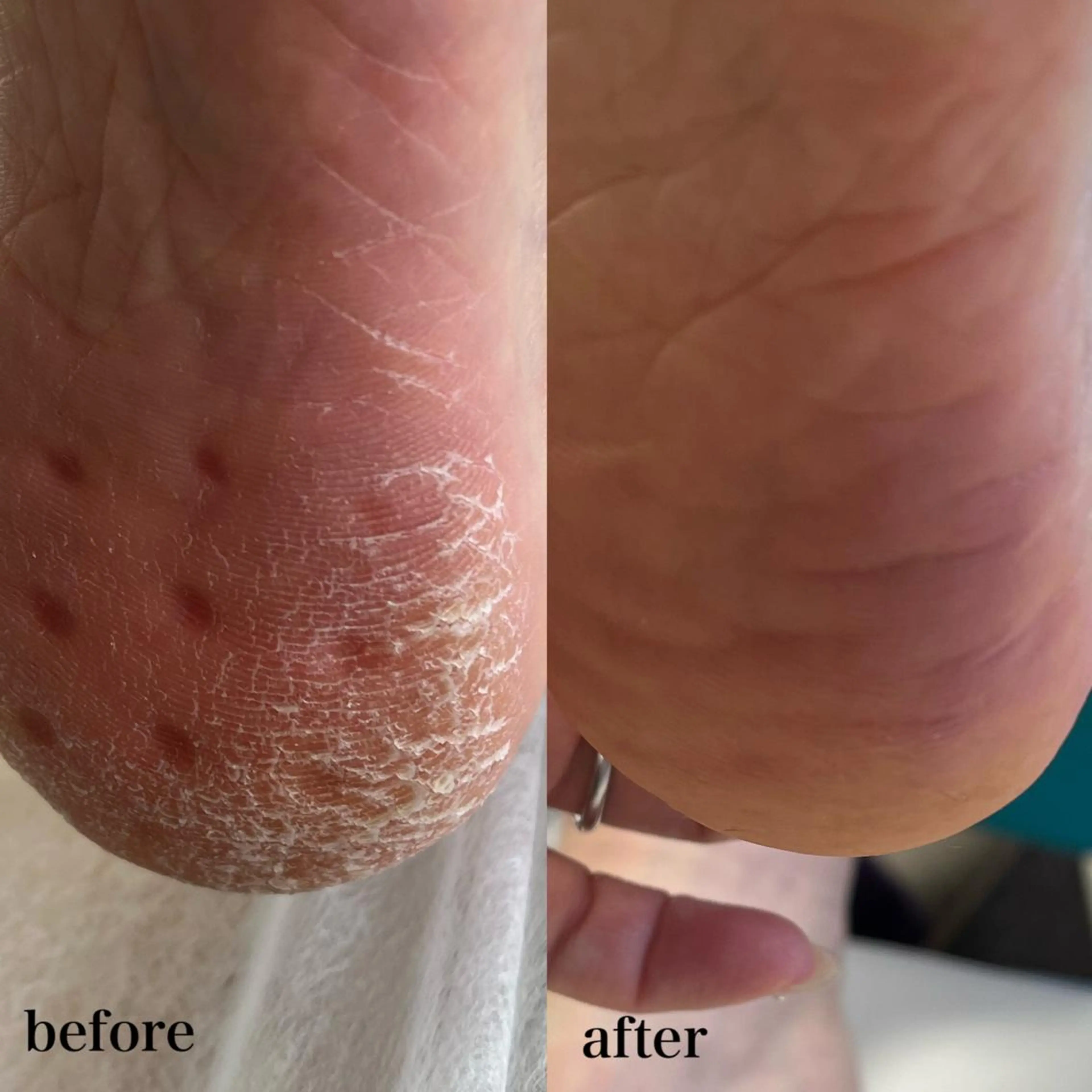 𝐑𝐢𝐞𝐯𝐞所属・HIROTA 𝐑𝐀𝐍のエステ・リラクイメージ