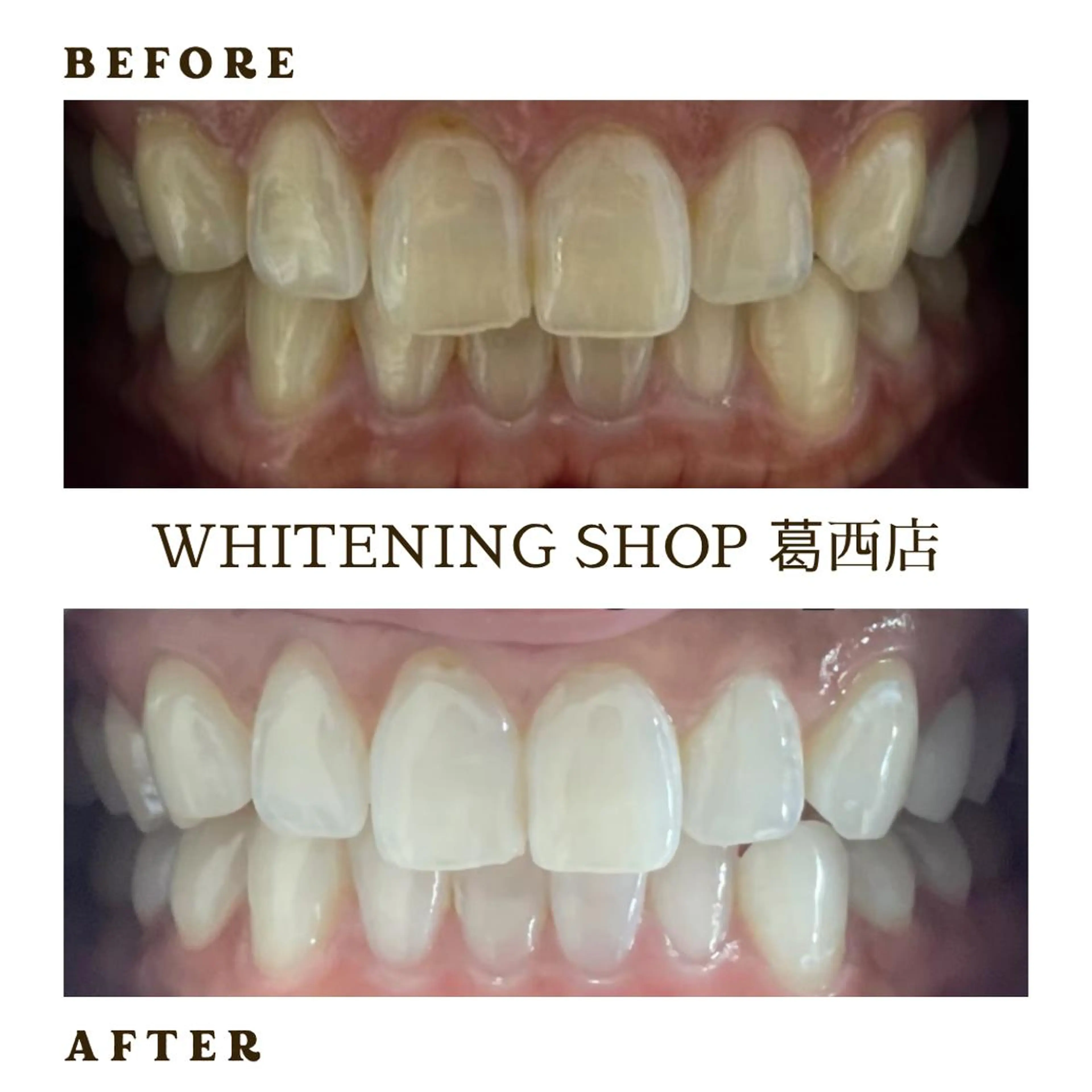 メンズ その他 ホワイトニング ショップ葛西店のその他イメージ