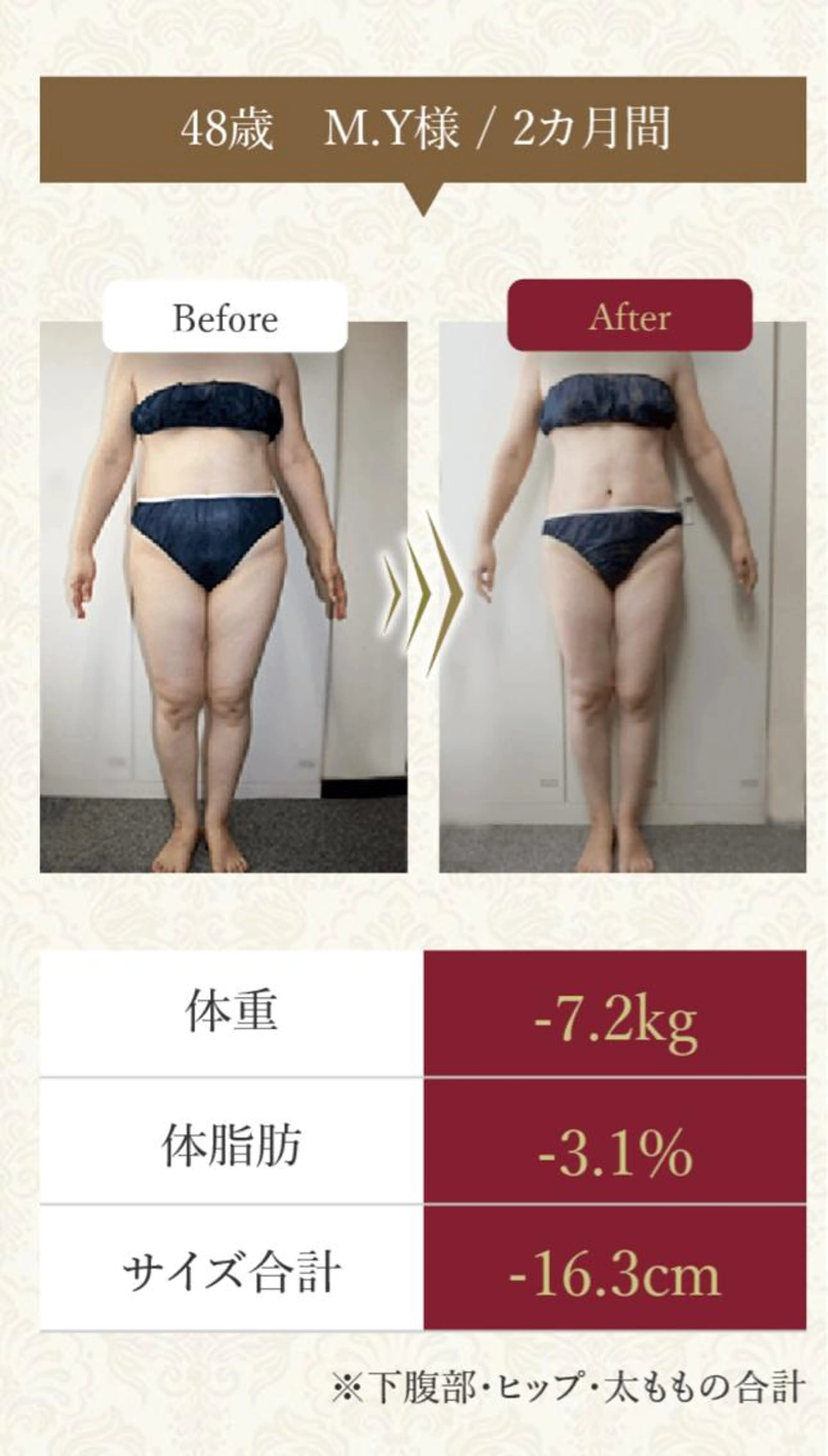 minimo限定痩身温活スリミング5回コースの写真