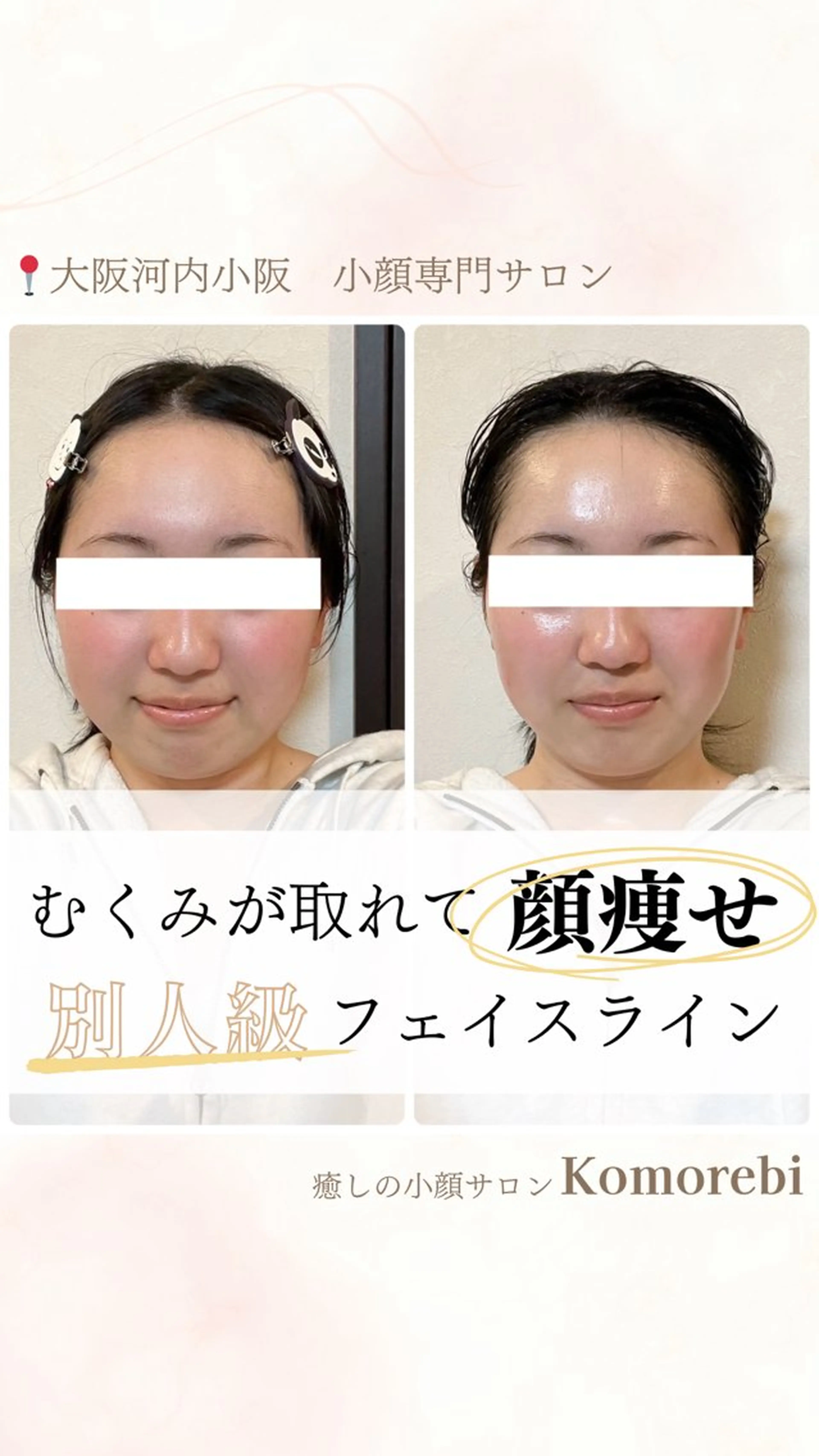 営業電話❌小顔サロン Komorebiのエステ・リラクイメージ