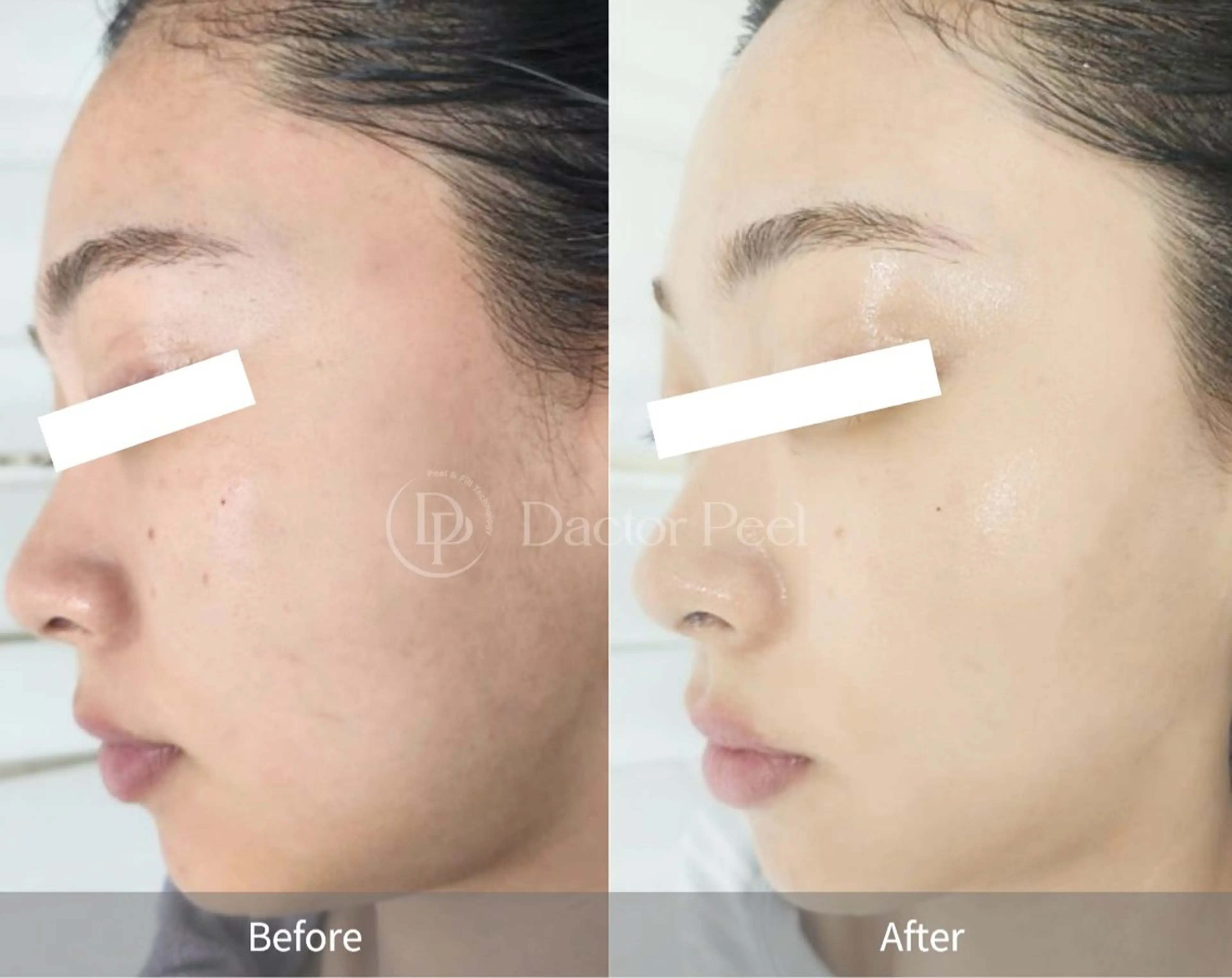 Honey Moom所属・Honey Moomのエステ・リラクイメージ