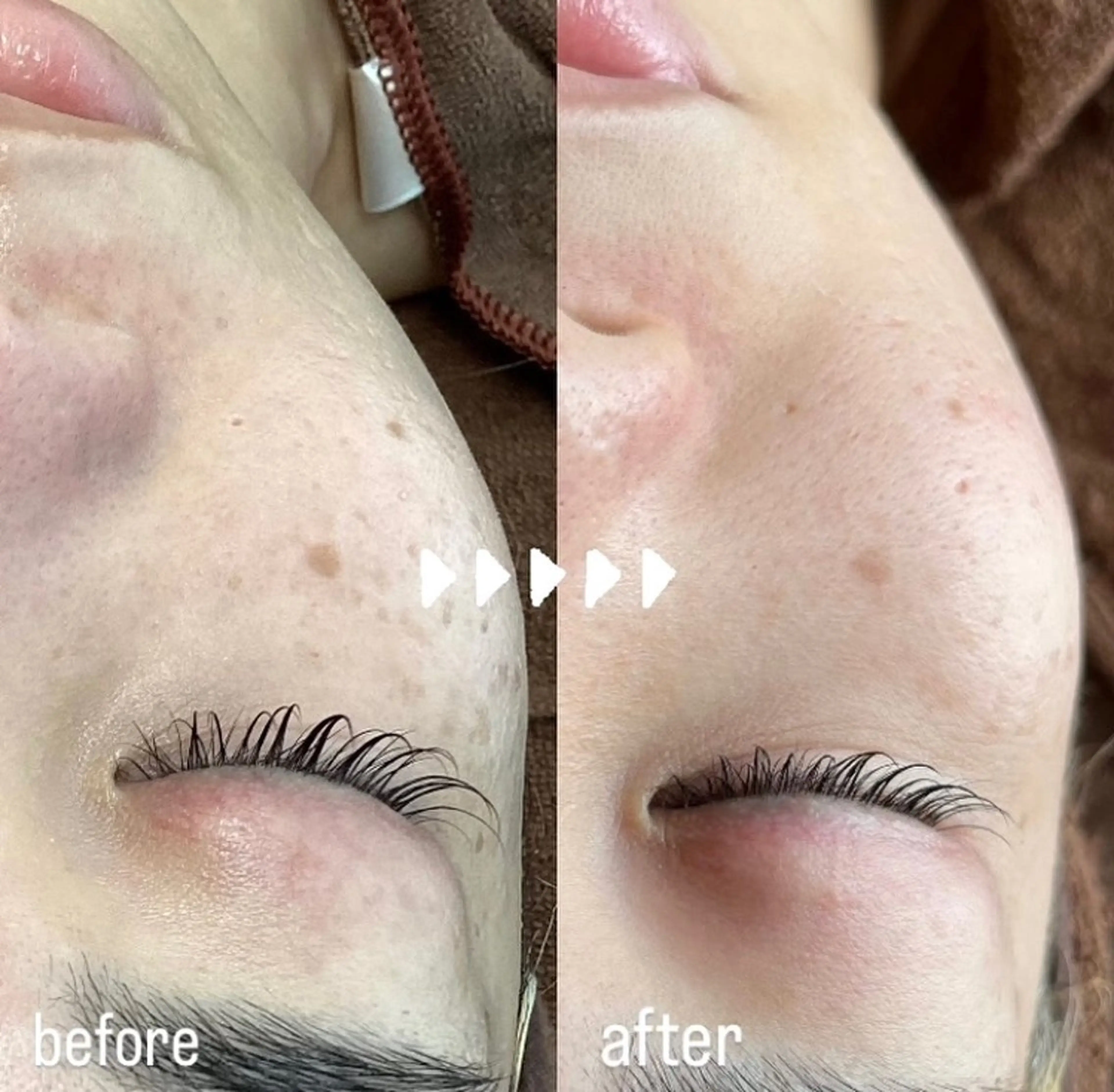 Rifuro 勝田台エステ所属・Rifuro勝田台 ララピール・毛穴洗浄のエステ・リラクイメージ