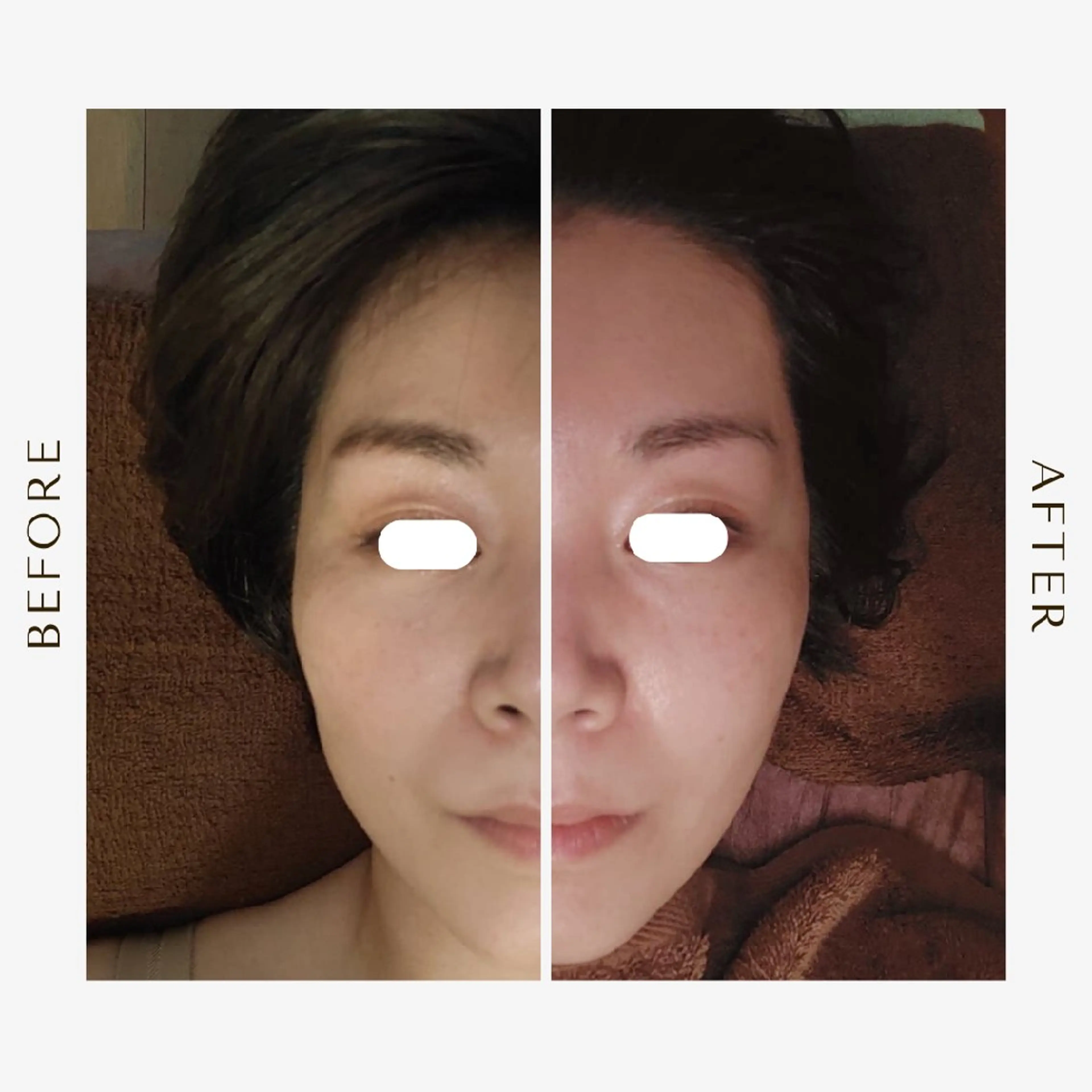 鍼灸サロンmiyabi所属・美容鍼×エステ　鍼灸 サロンmiyabiのエステ・リラクイメージ