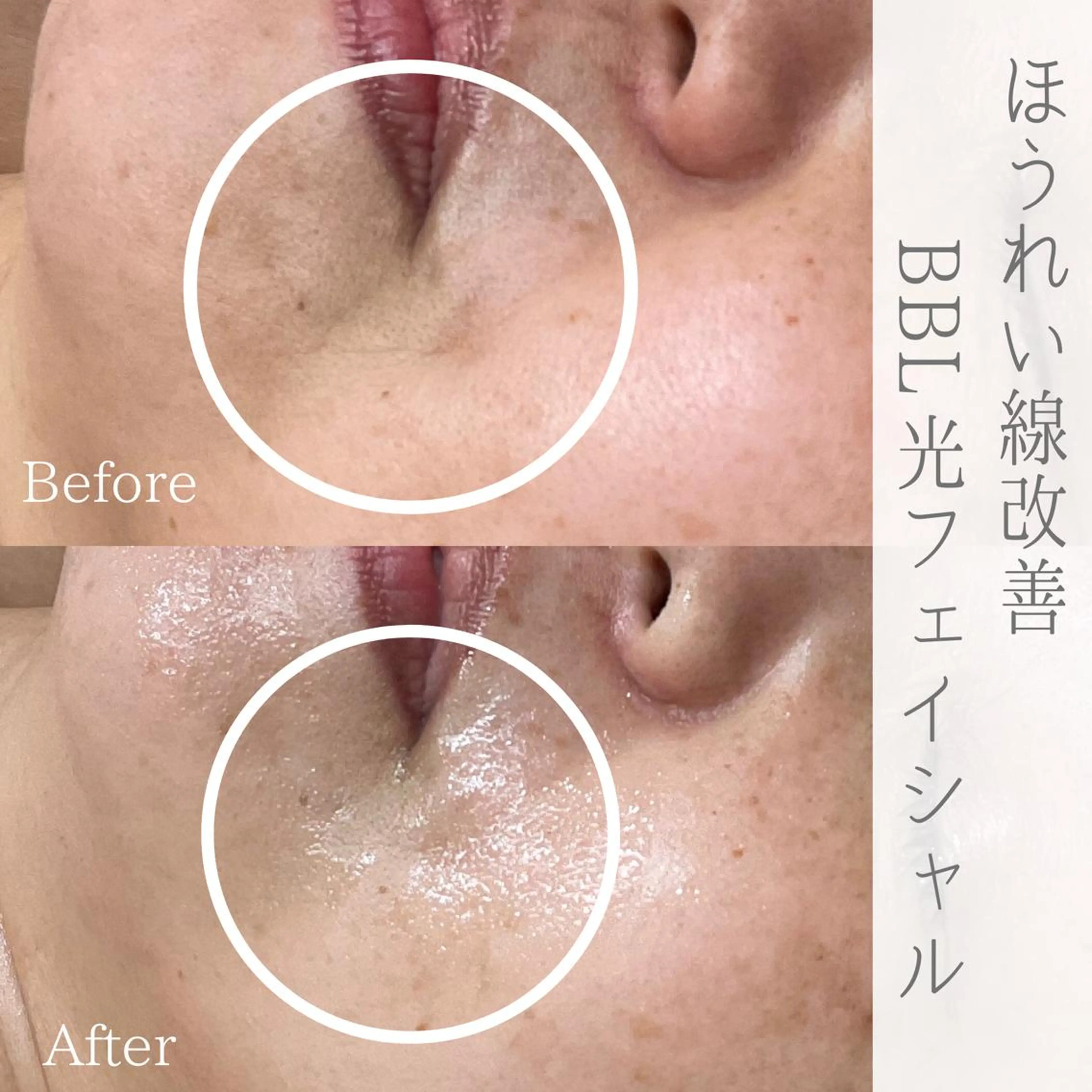 エステ ciena KAYOのその他イメージ