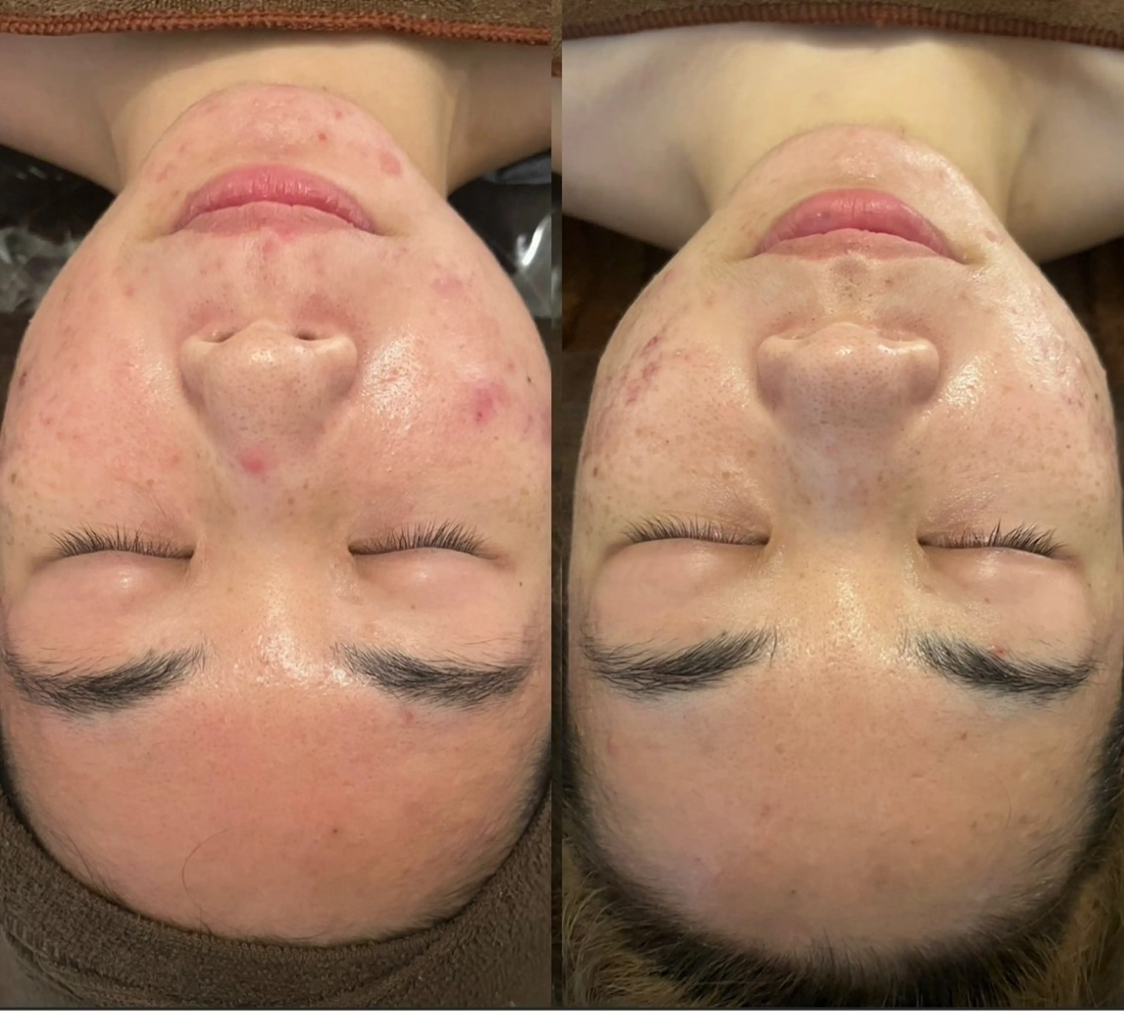 oyam オヤムのエステ・リラクイメージ