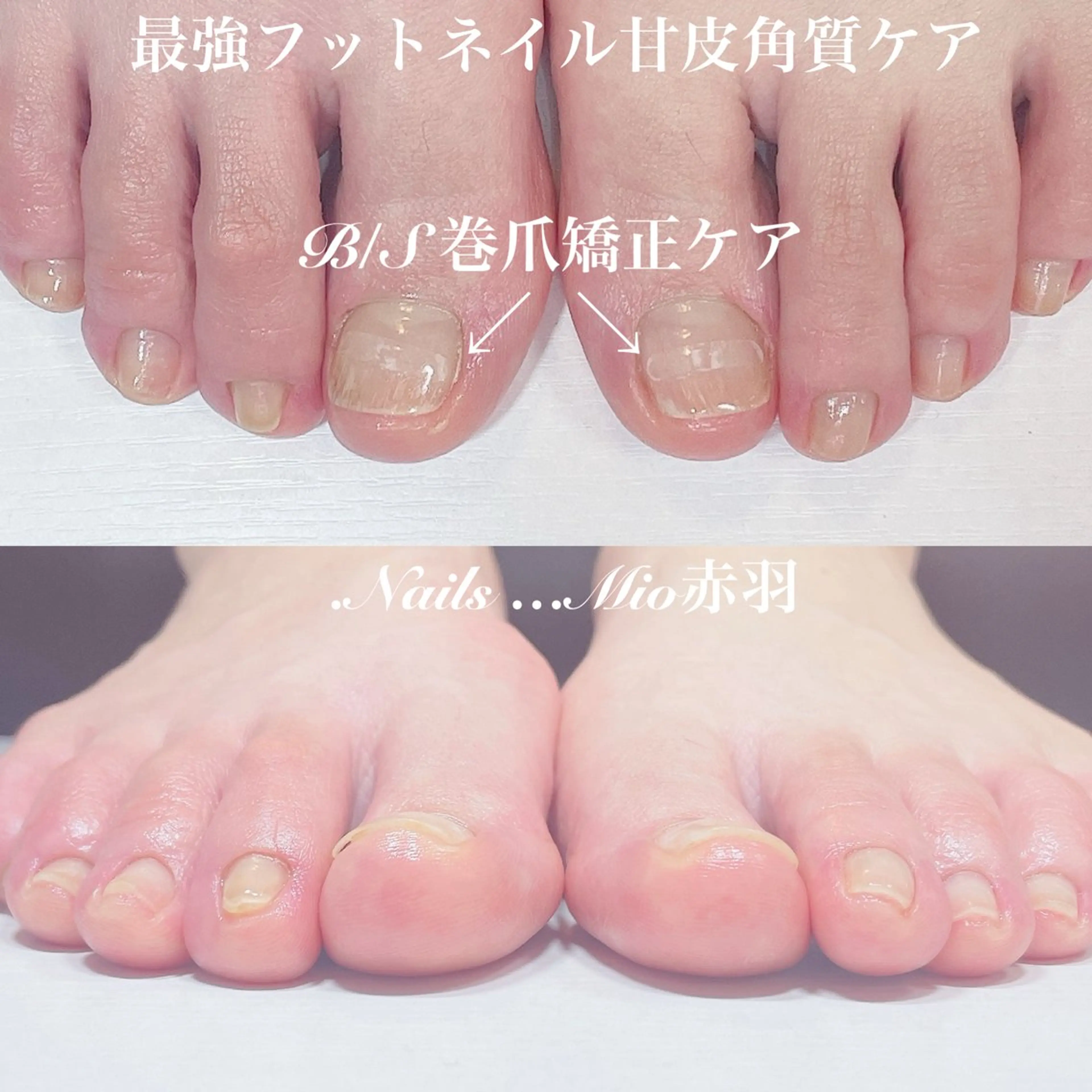 ネイル フットネイル .Nails Mio 赤羽西ネイルサロンのネイルデザイン