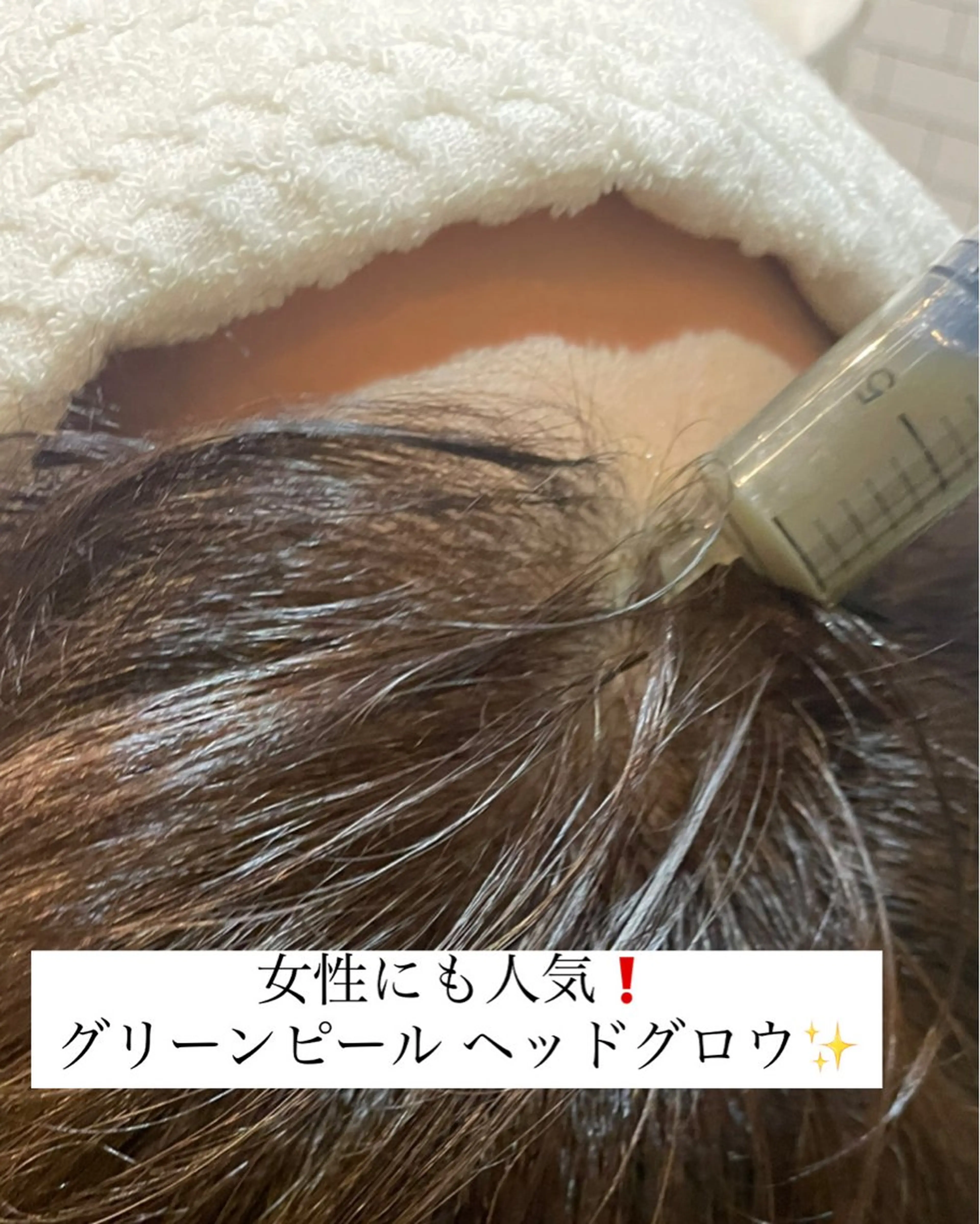 ヘッドグロウ(シングル)の写真