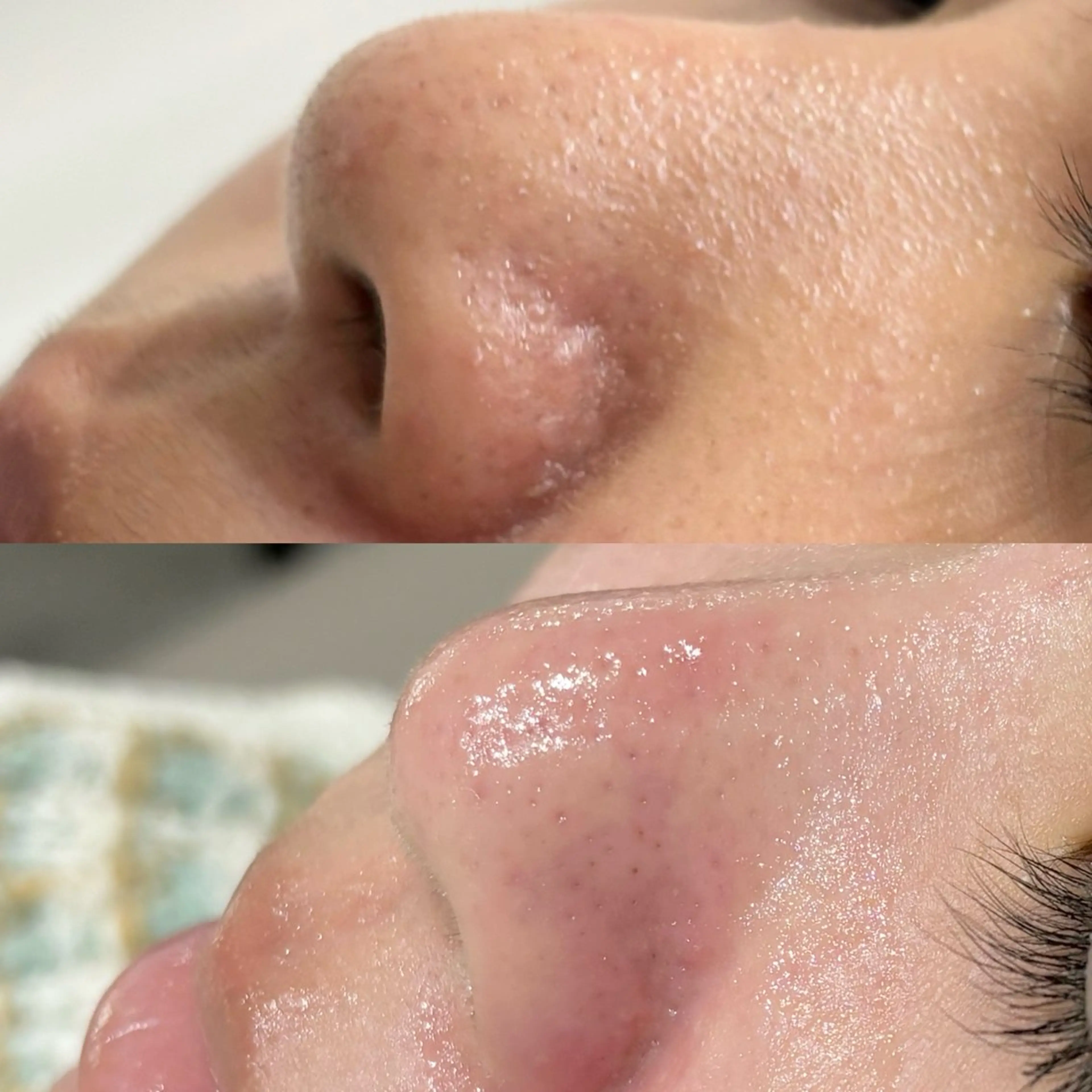 毛穴に特化したサロン MYFAIRLADYのエステ・リラクイメージ