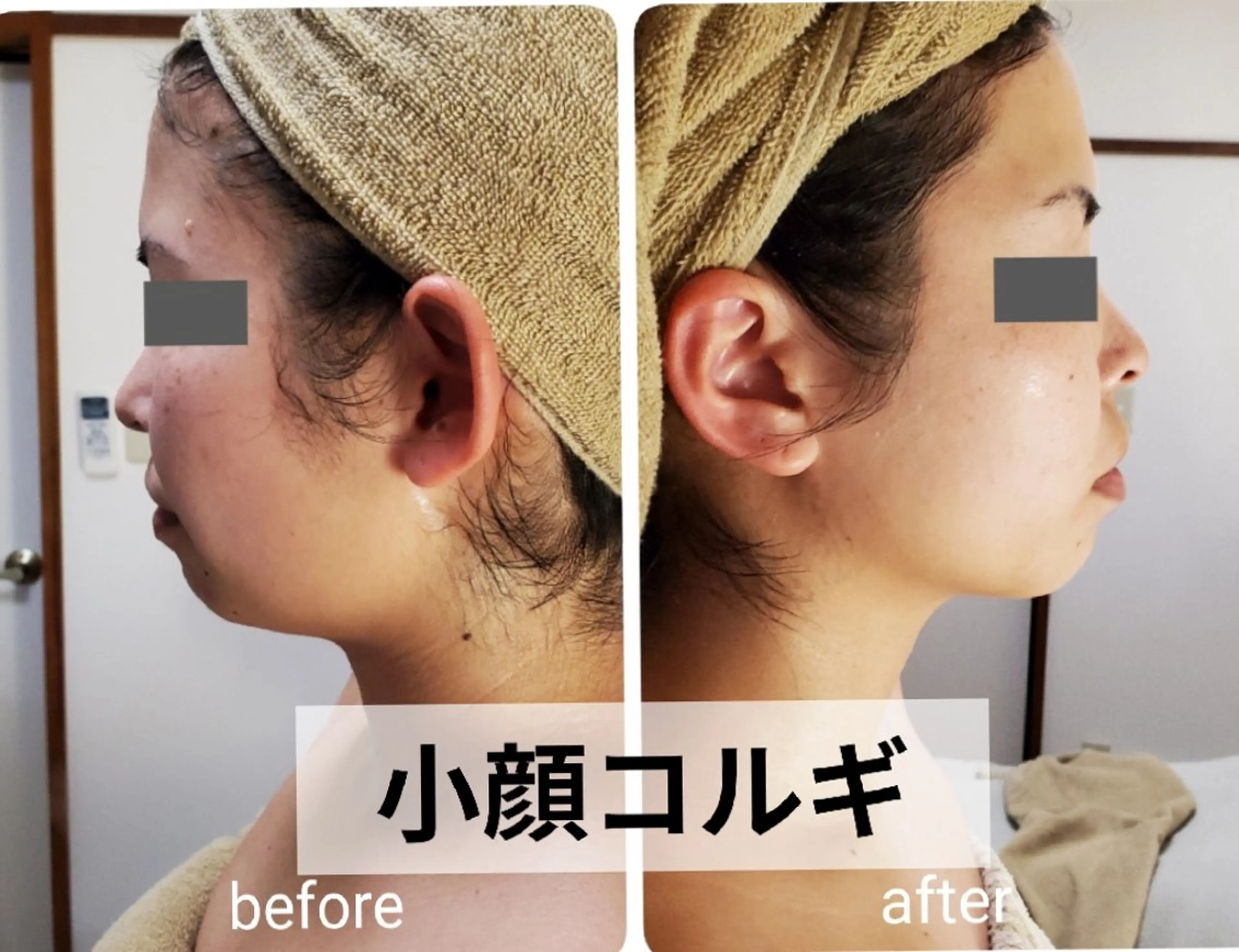 小顔コルギ(角質ケア、パック付き)の写真