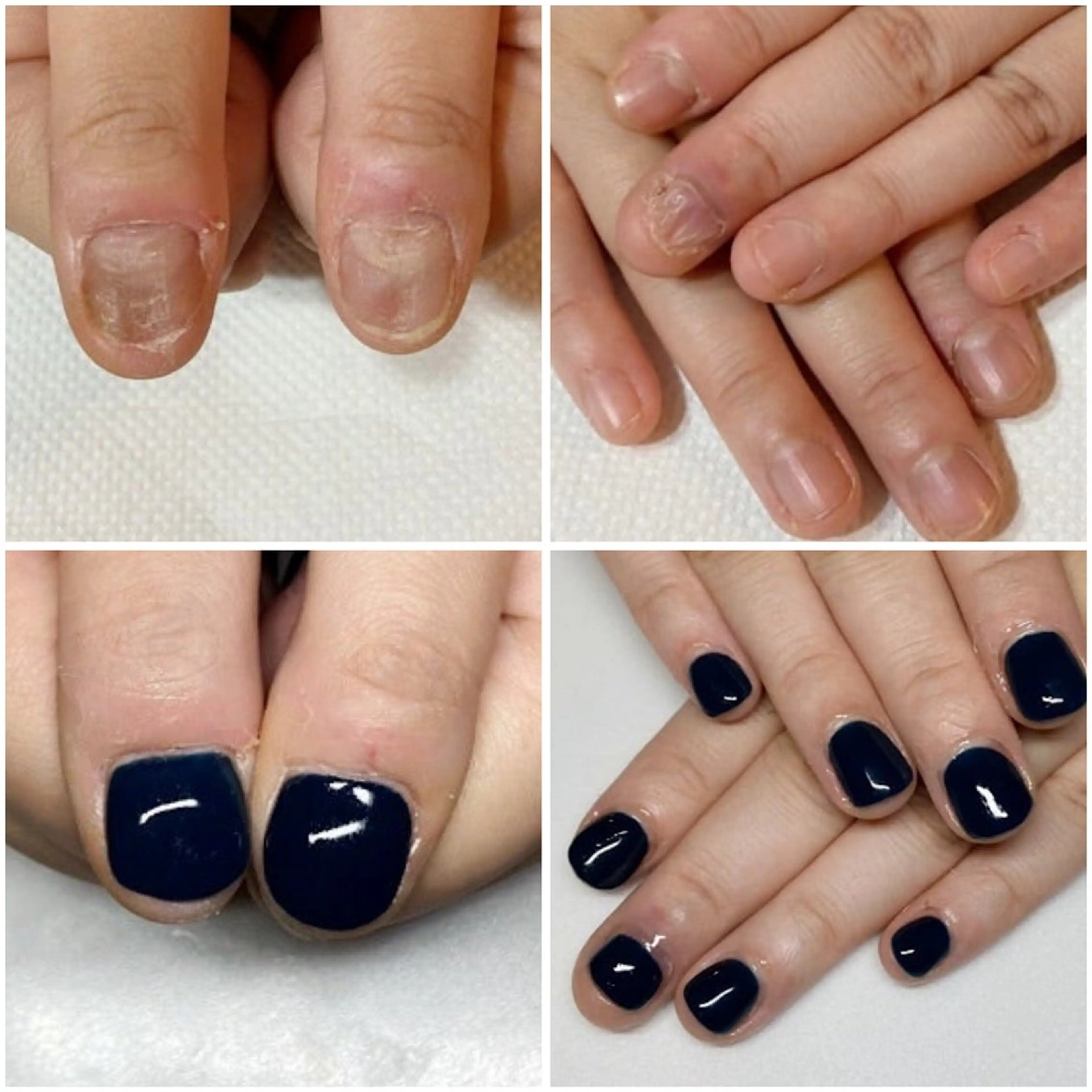 ネイル ネイルサロンアリューム所属・ネイルサロン アリュームのネイルデザイン