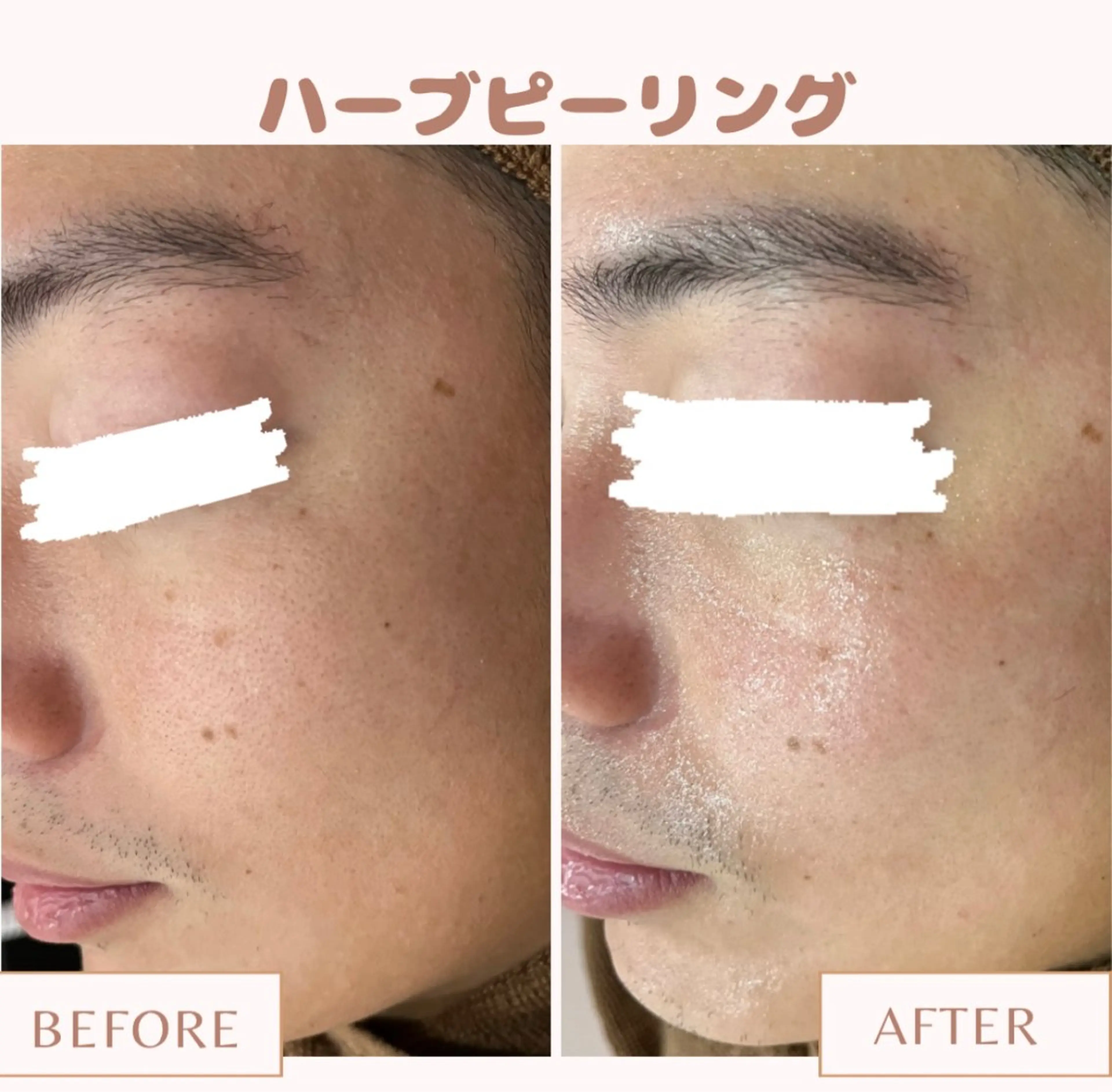 メンズ キッズ Amaryllis 💜河田のエステ・リラクイメージ