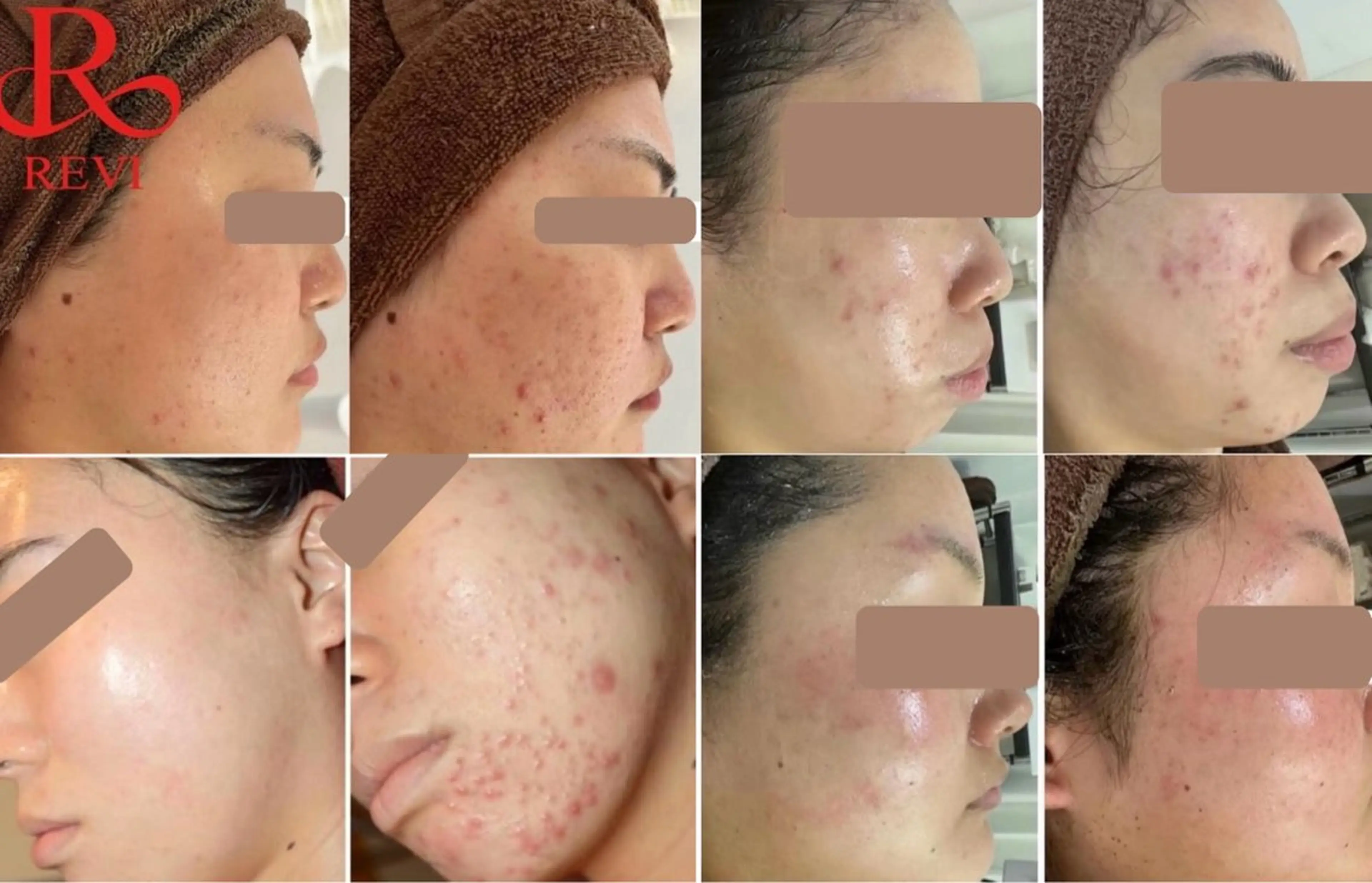 中目黒ハーブピーリン グ🌿ララピールのエステ・リラクイメージ