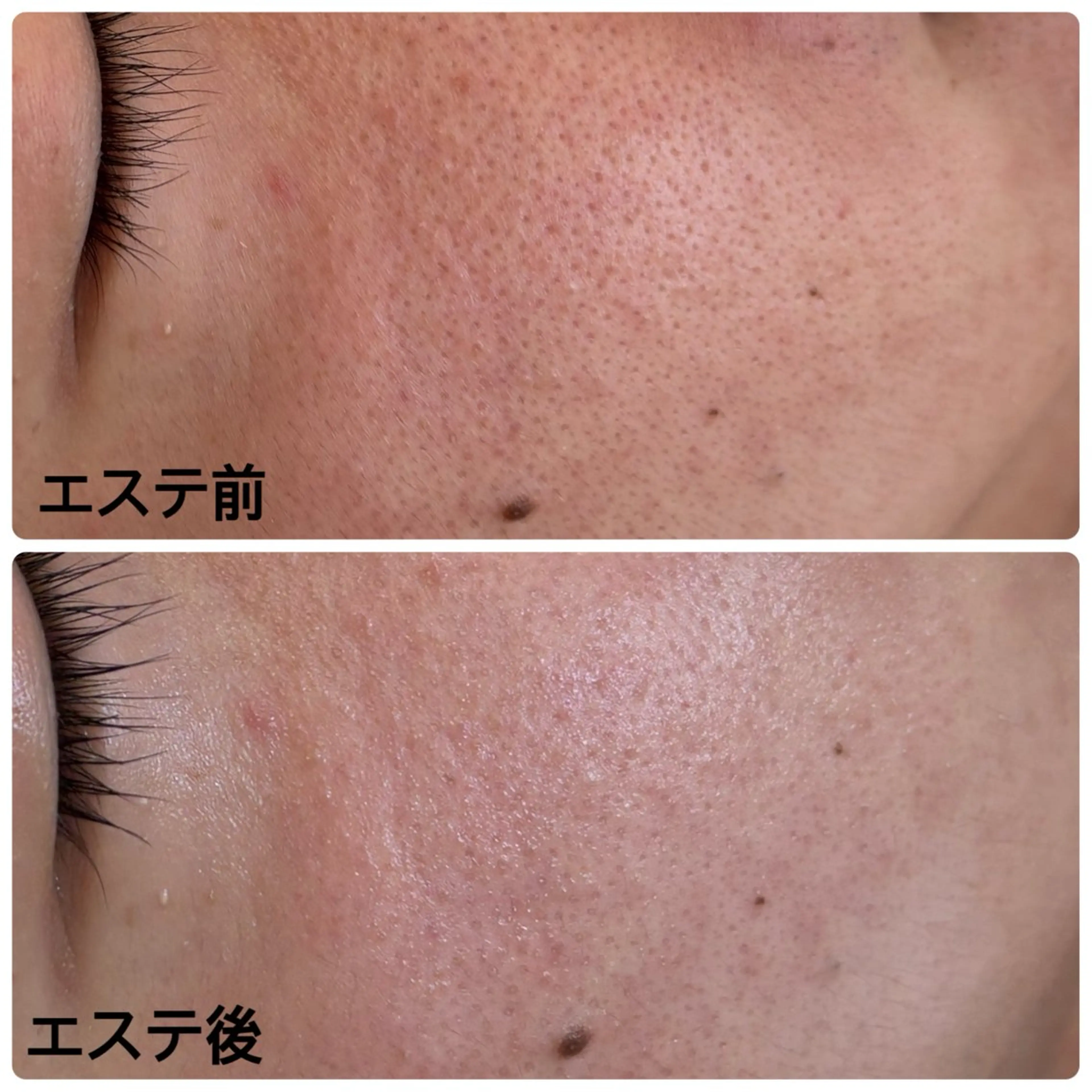 エステ リラク デアイム石岡所属・網代 綾美のエステ・リラクイメージ