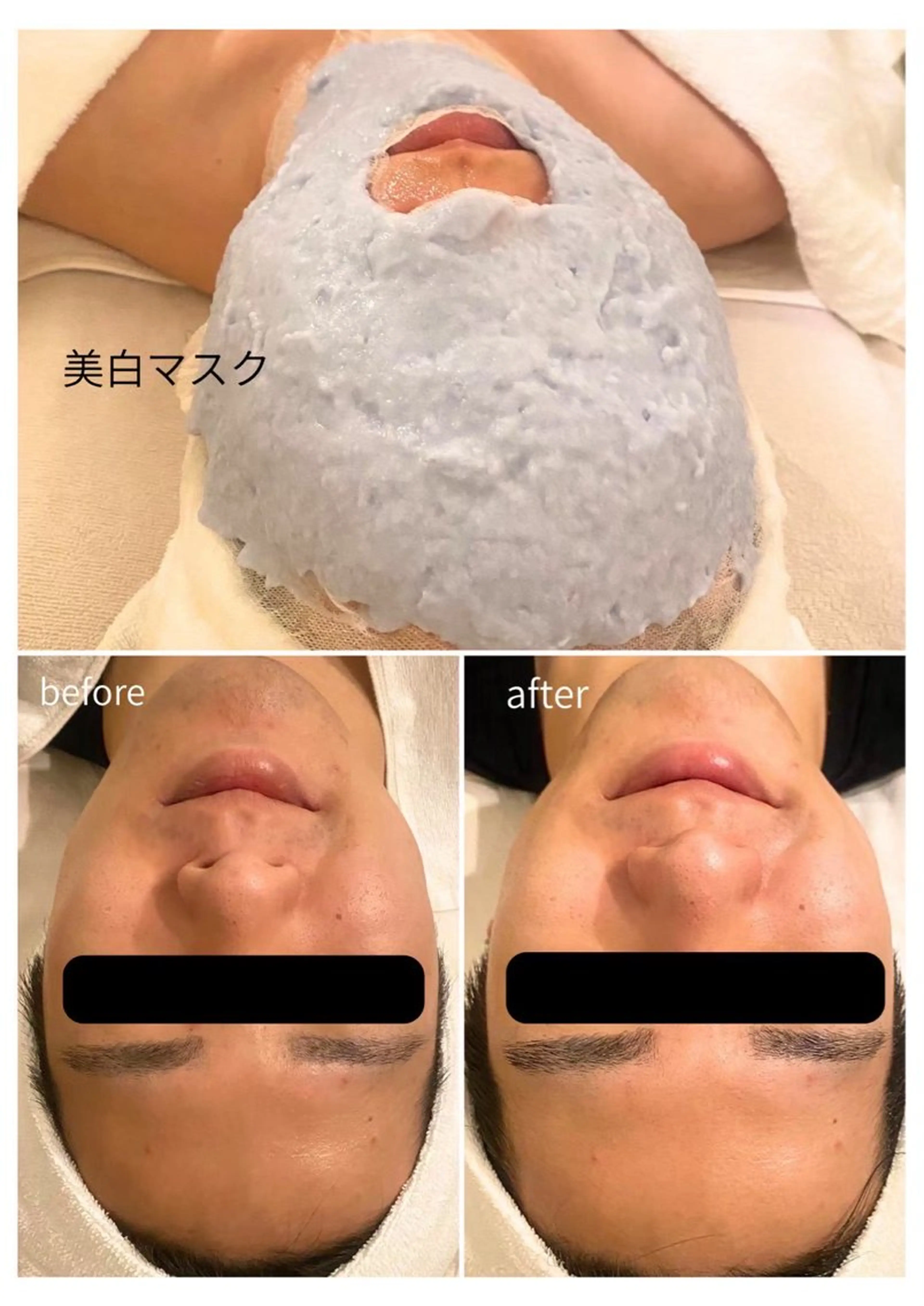 Pola R-isa 南船場所属・毛穴・くすみ・肩こり エステ/POLAのその他イメージ