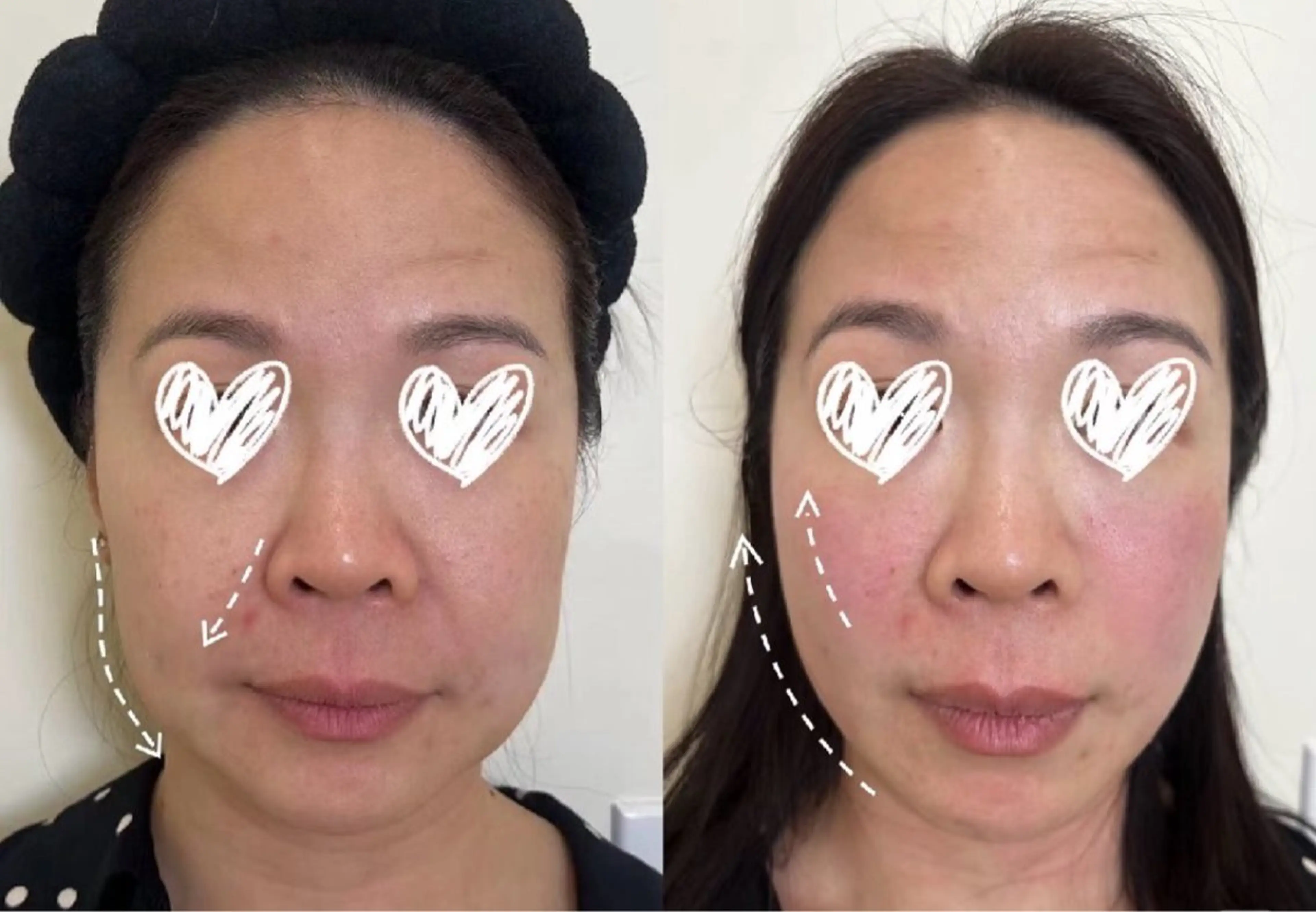 マツエク・マツパ エステ aliaハイフ&水光ジェットサロン所属・aliaハーブ水光店 エステティシャン募集のエステ・リラクイメージ