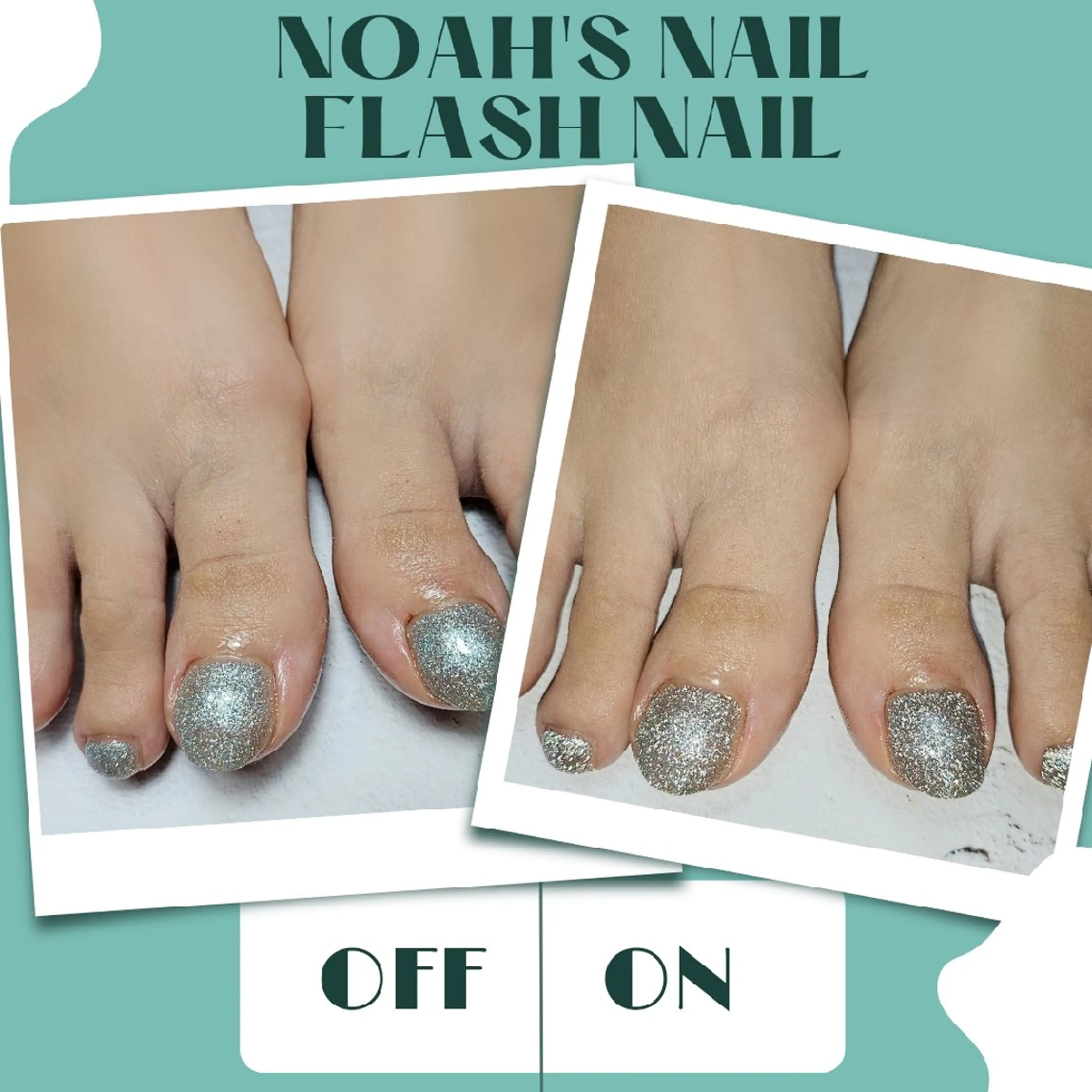 ネイル フラッシュネイル フットネイル Noah'snail   のネイルデザイン