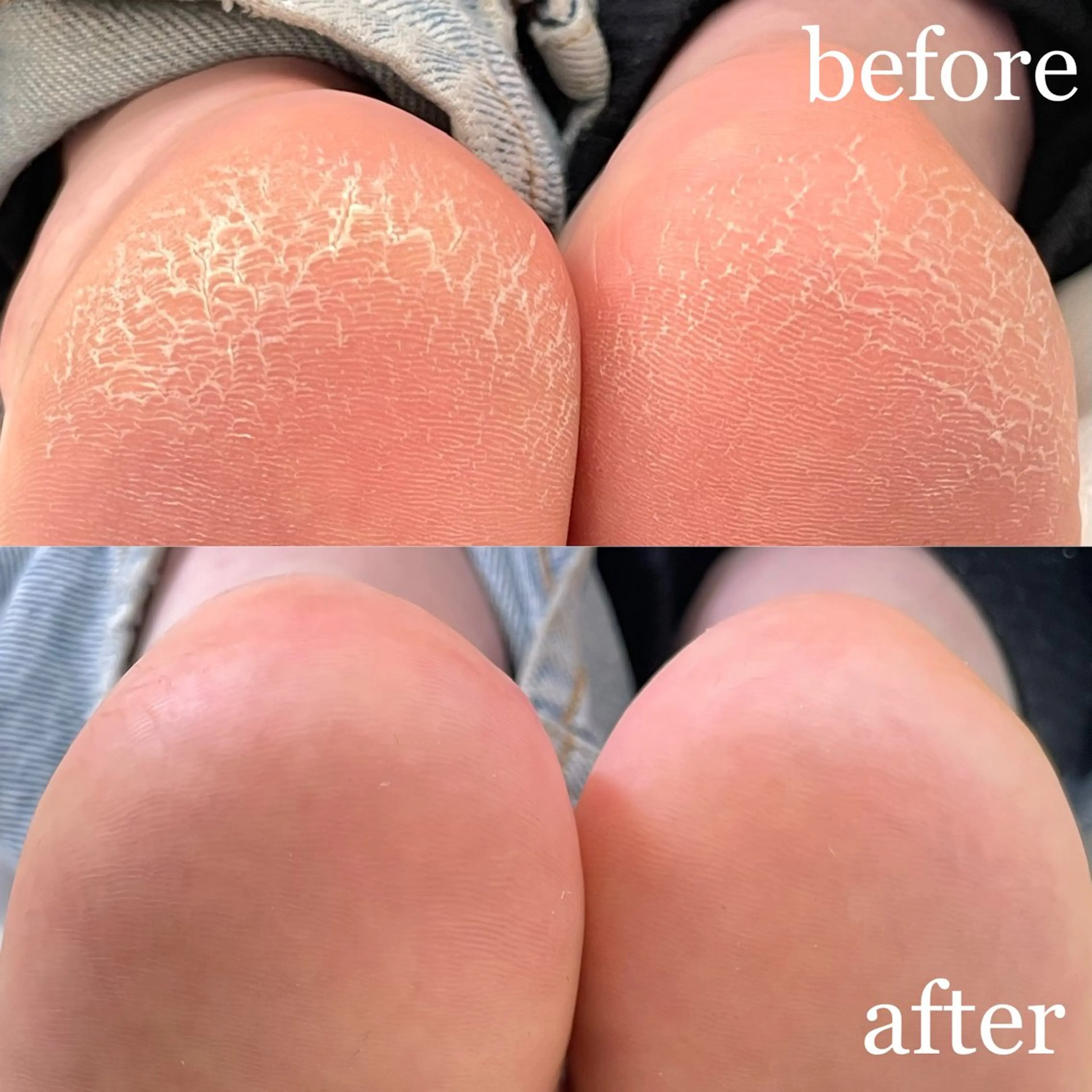 ネイル フットネイル franfika 川又のマツエク・マツパデザイン