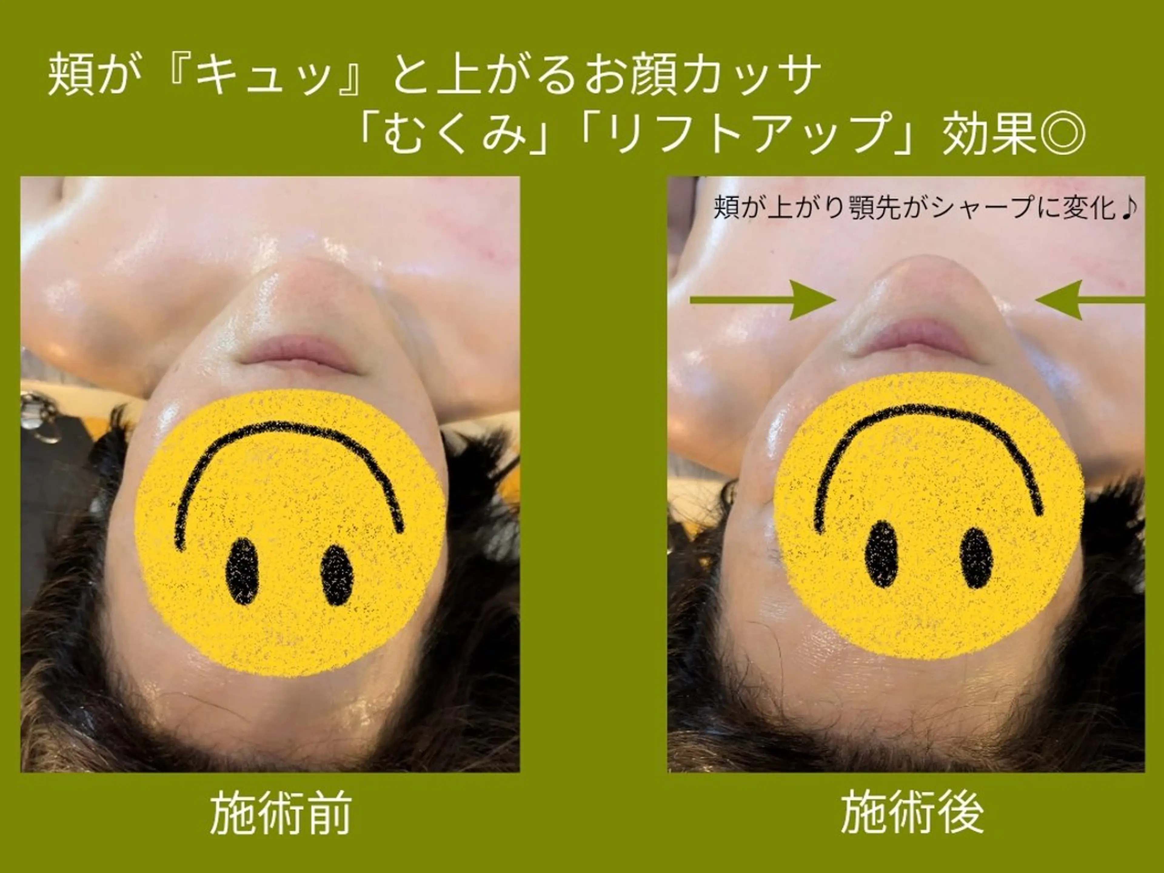 カッサ・カッピング専門サロン 水玉屋−suidamaya−所属・カッサ・カッピング 専門サロン/水玉屋のエステ・リラクイメージ