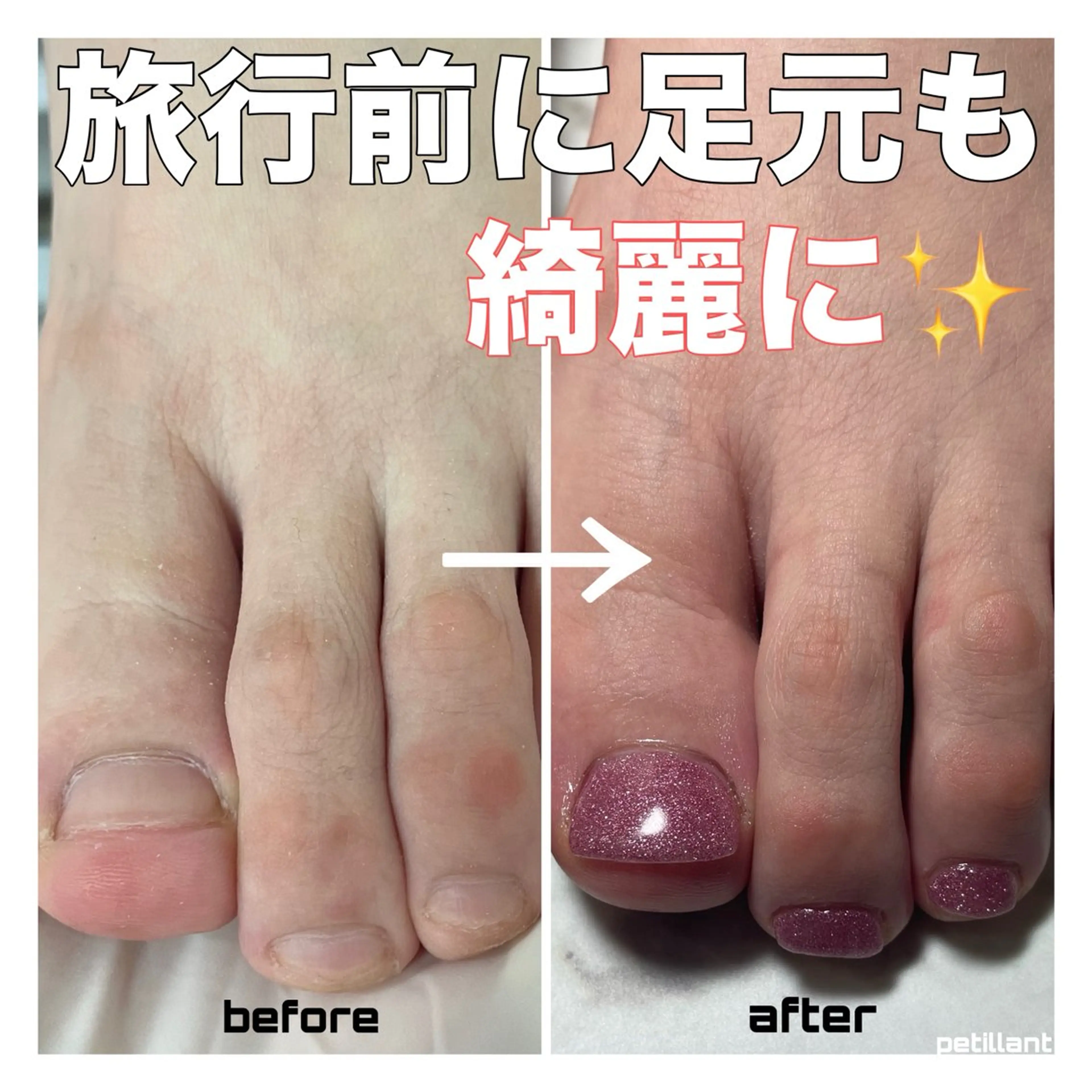 ネイル フットネイル petillant所属・nail salon petillantのネイルデザイン