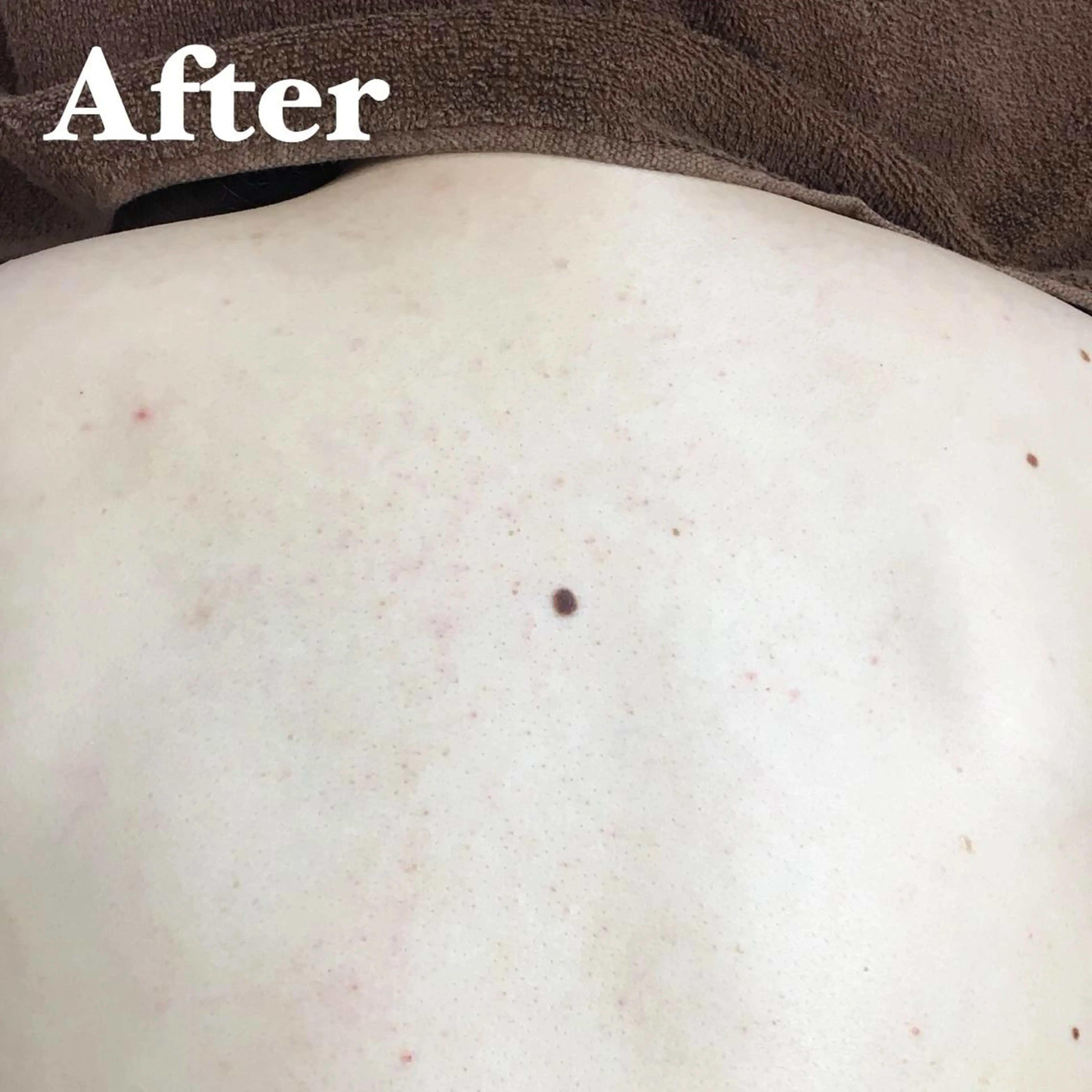 MIMI BEAUTY SALON所属・MIMI 吉祥寺2号店のエステ・リラクイメージ