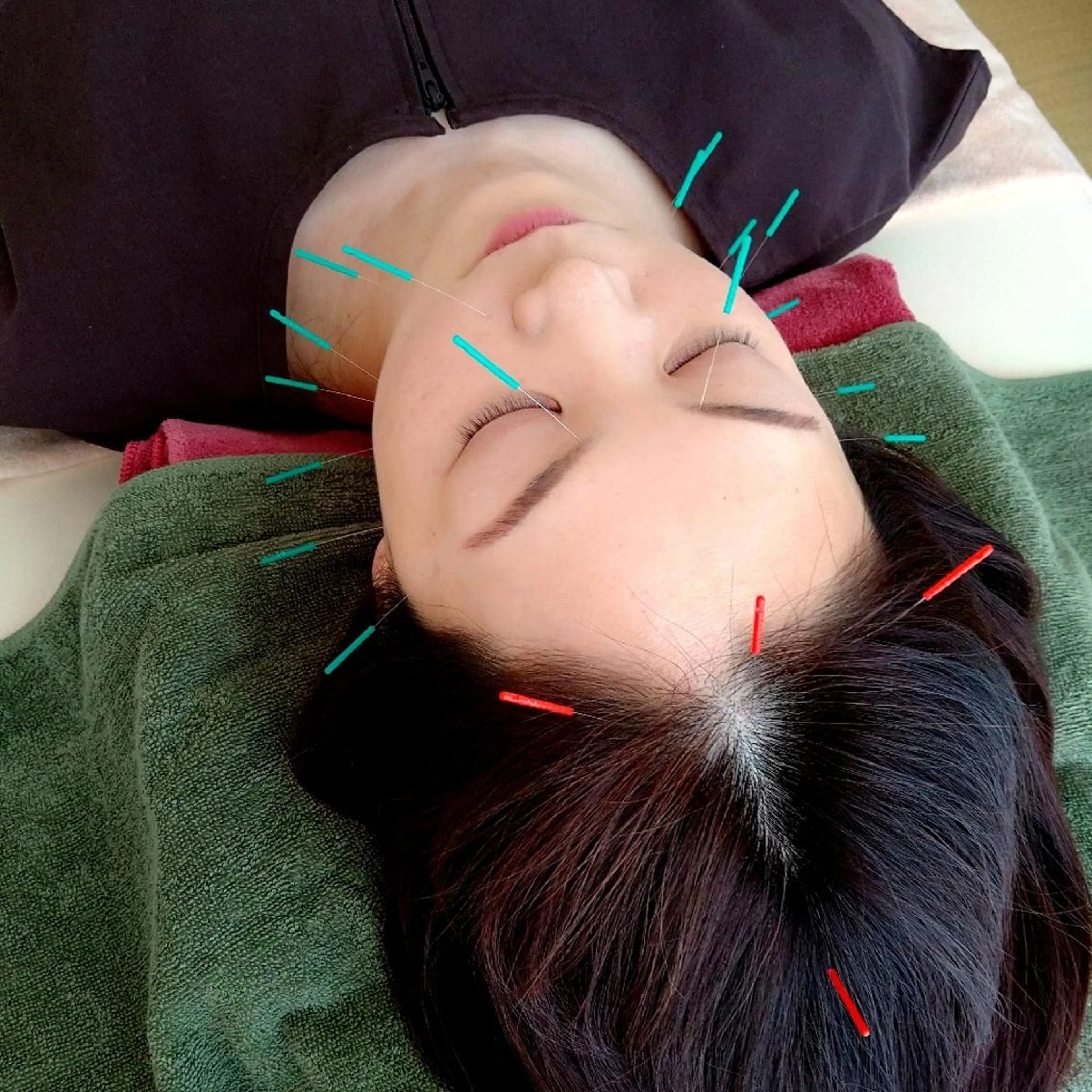 エステ リラク 美身鍼灸はりごこち (大峰)のエステ・リラクイメージ