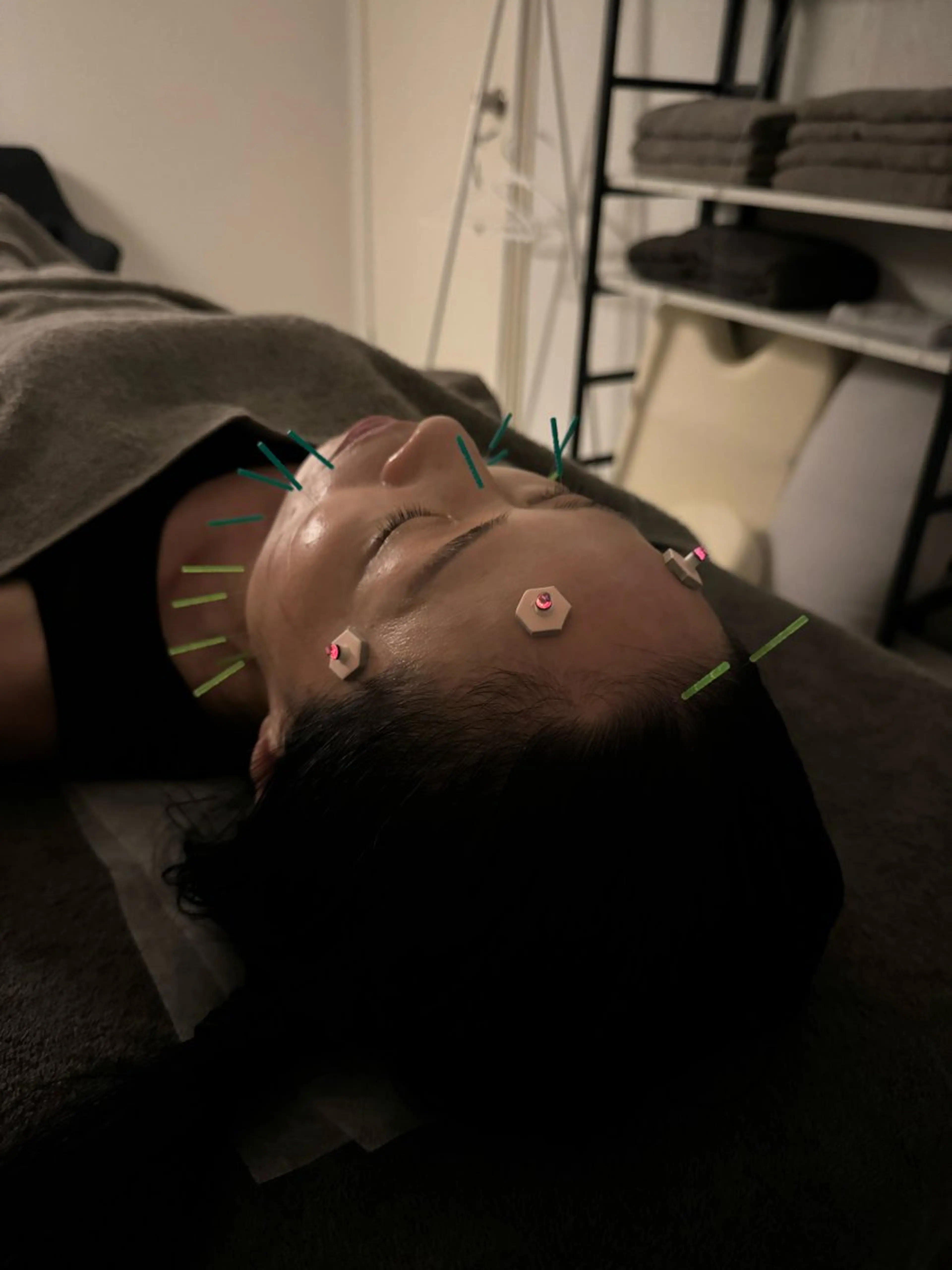 エステ リラク 美容鍼×小顔矯正 ×美容整体　浜川泰仁のエステ・リラクイメージ