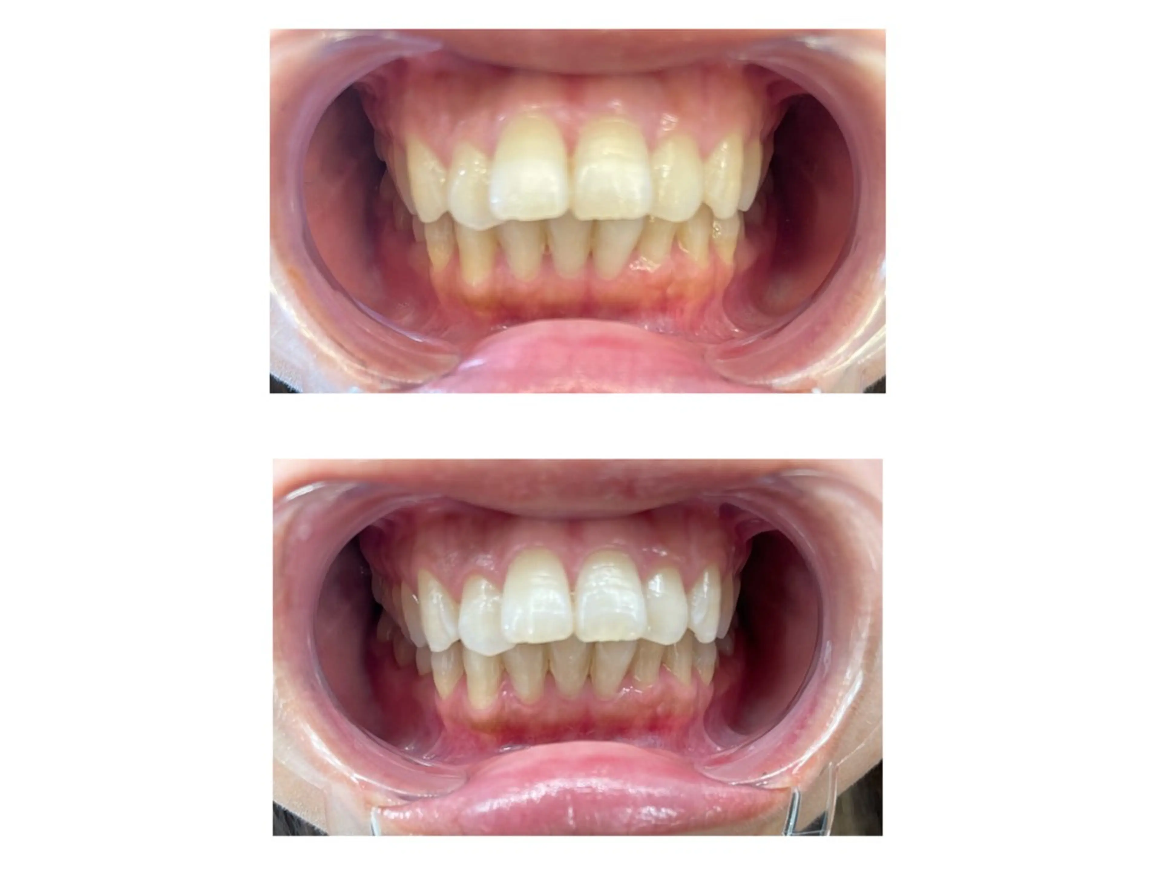 サロンピュア 所沢店のエステ・リラクイメージ