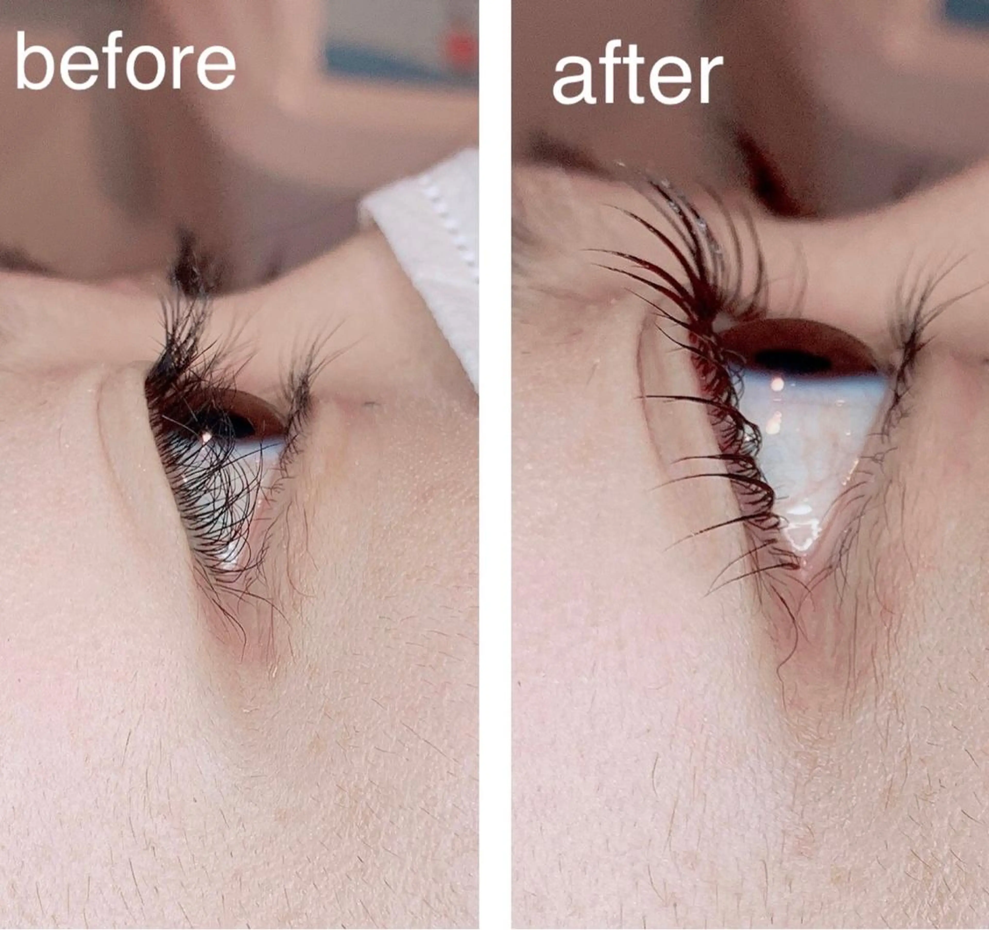 マツエク・マツパ 痩身専門サロン ビューティーグランツのエステ・リラクイメージ