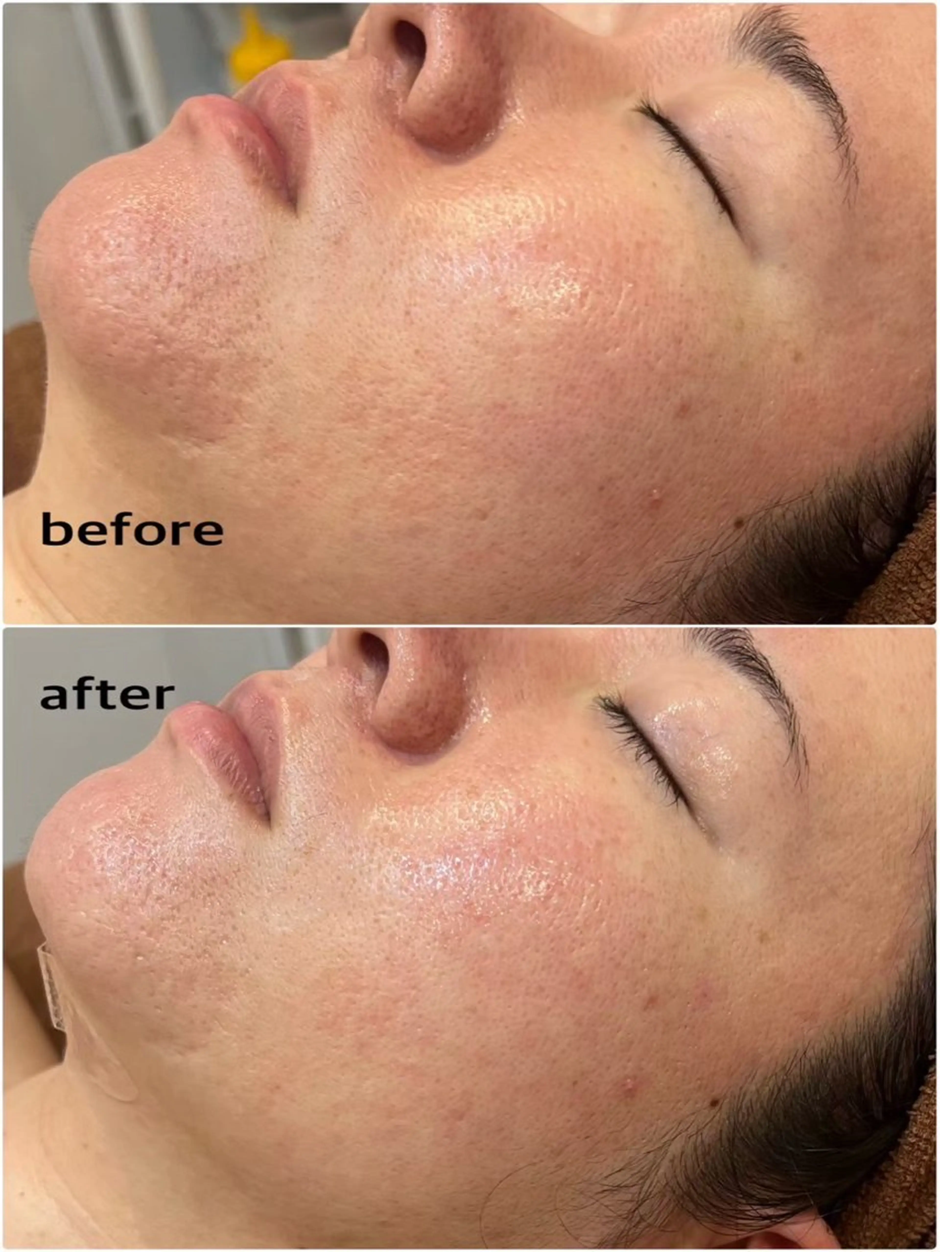 エステ まつげパーマ×眉毛×脱毛　Cerise Lala所属・CeriesLaLa 大船店のエステ・リラクイメージ