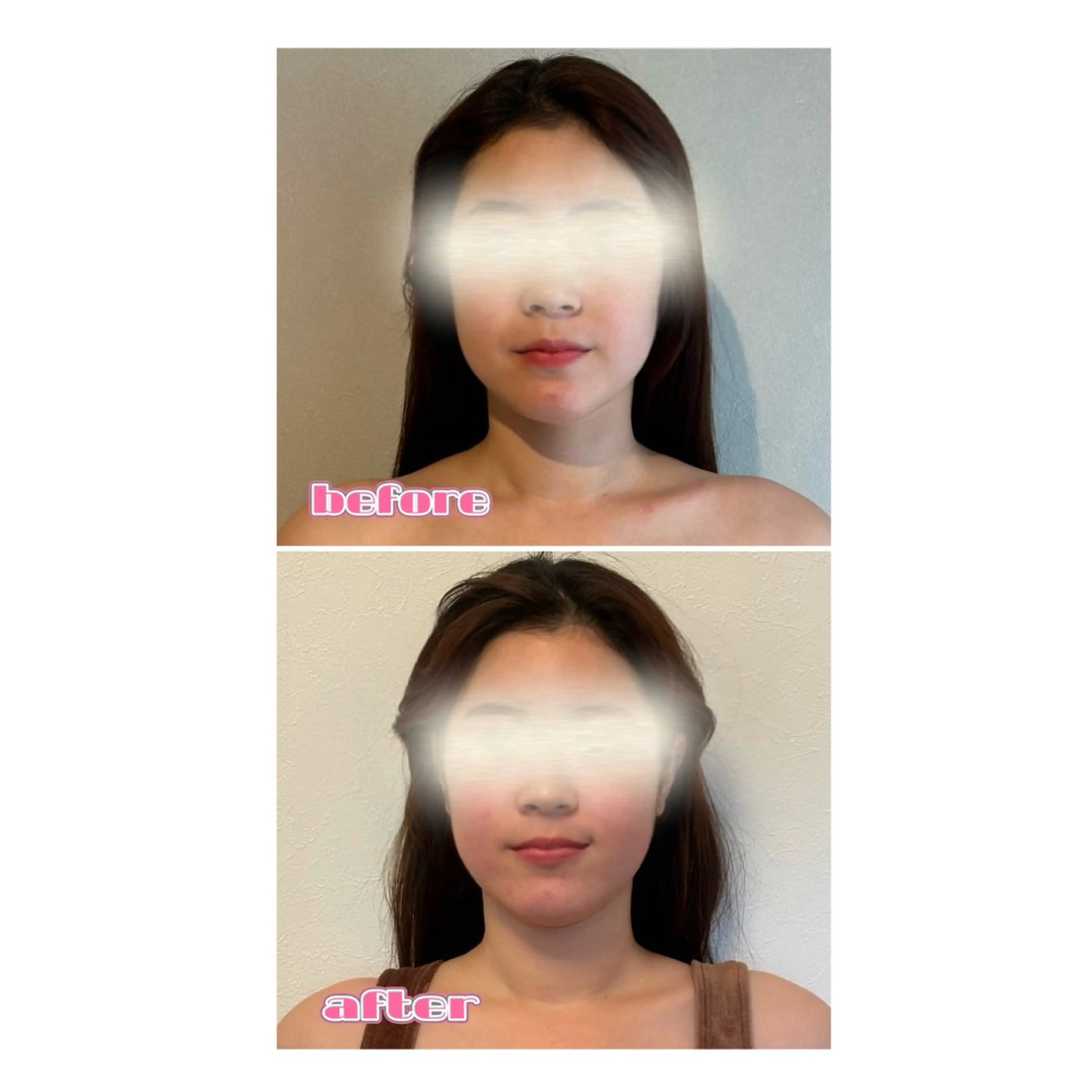 平日11:00~16:00限定❗️小顔90minコース990円体験💎【¥20,900→¥990】イベント期間内のみの写真