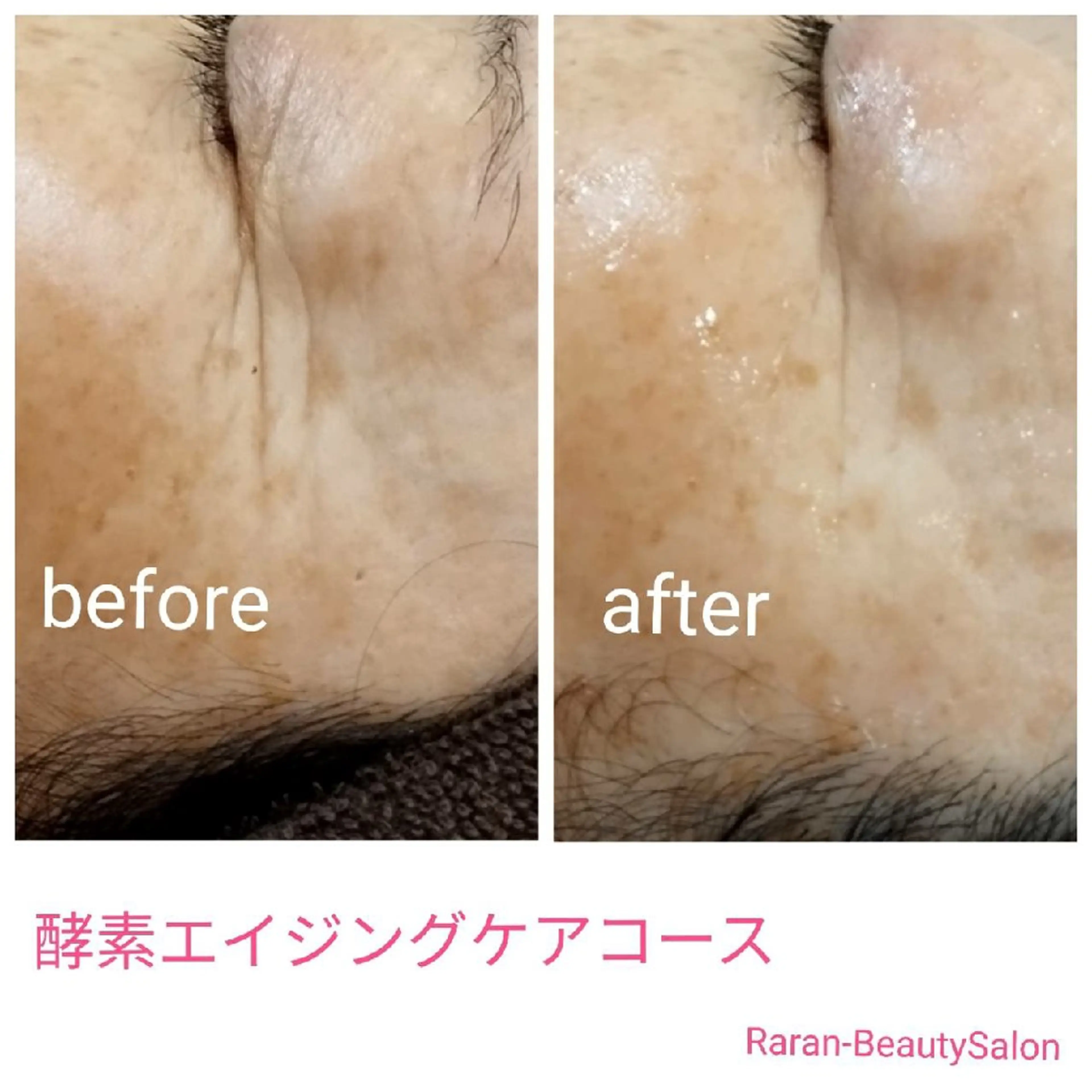 若返り 美肌   エステサロンららんのエステ・リラクイメージ