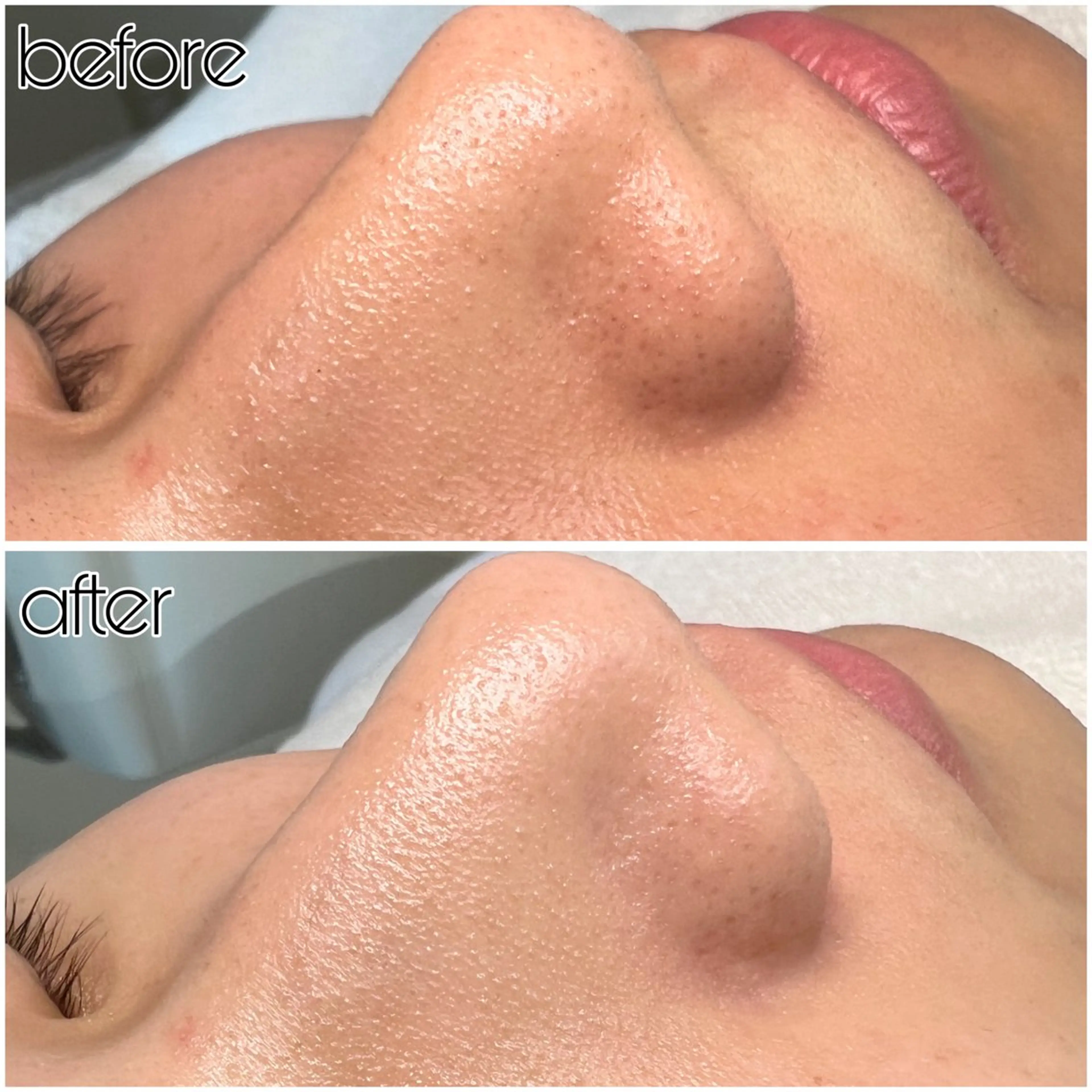 その他 SHECIAお顔剃りシェービング専門店所属・お顔剃りエステサロン SHECIAのその他イメージ