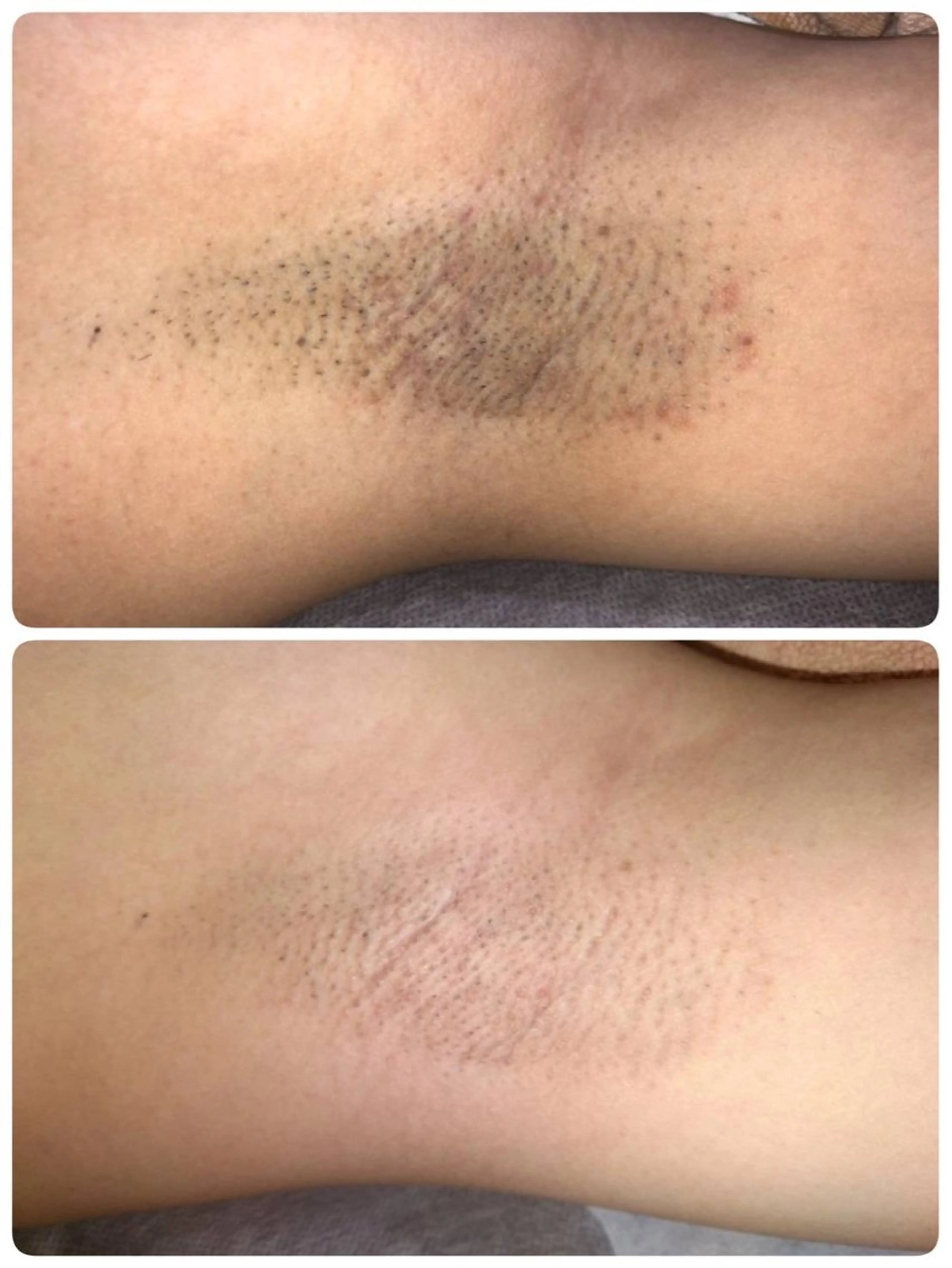 Laule'a ラウレアのエステ・リラクイメージ