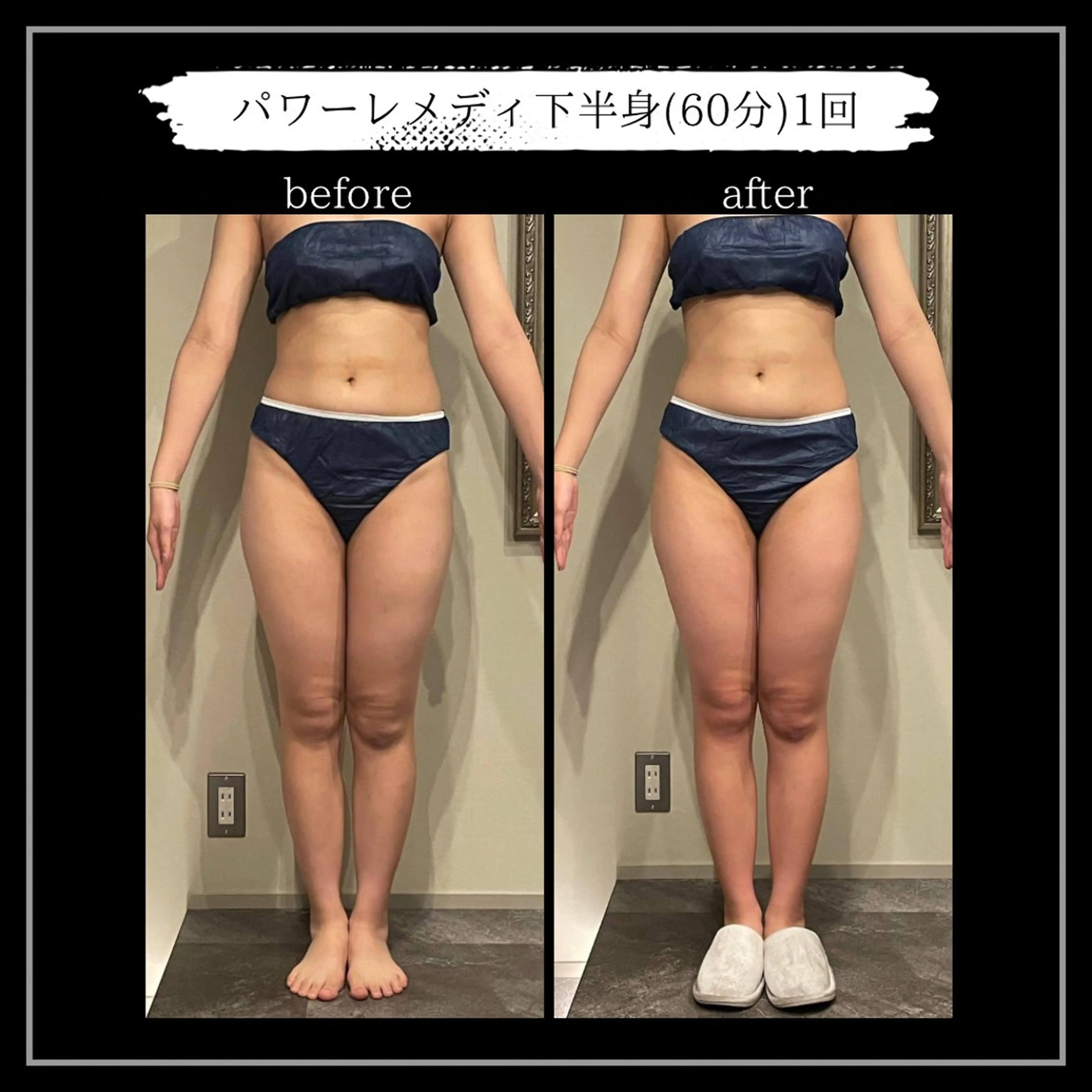 オフ:オン所属・オフ:オン 全身筋膜マッサージのエステ・リラクイメージ