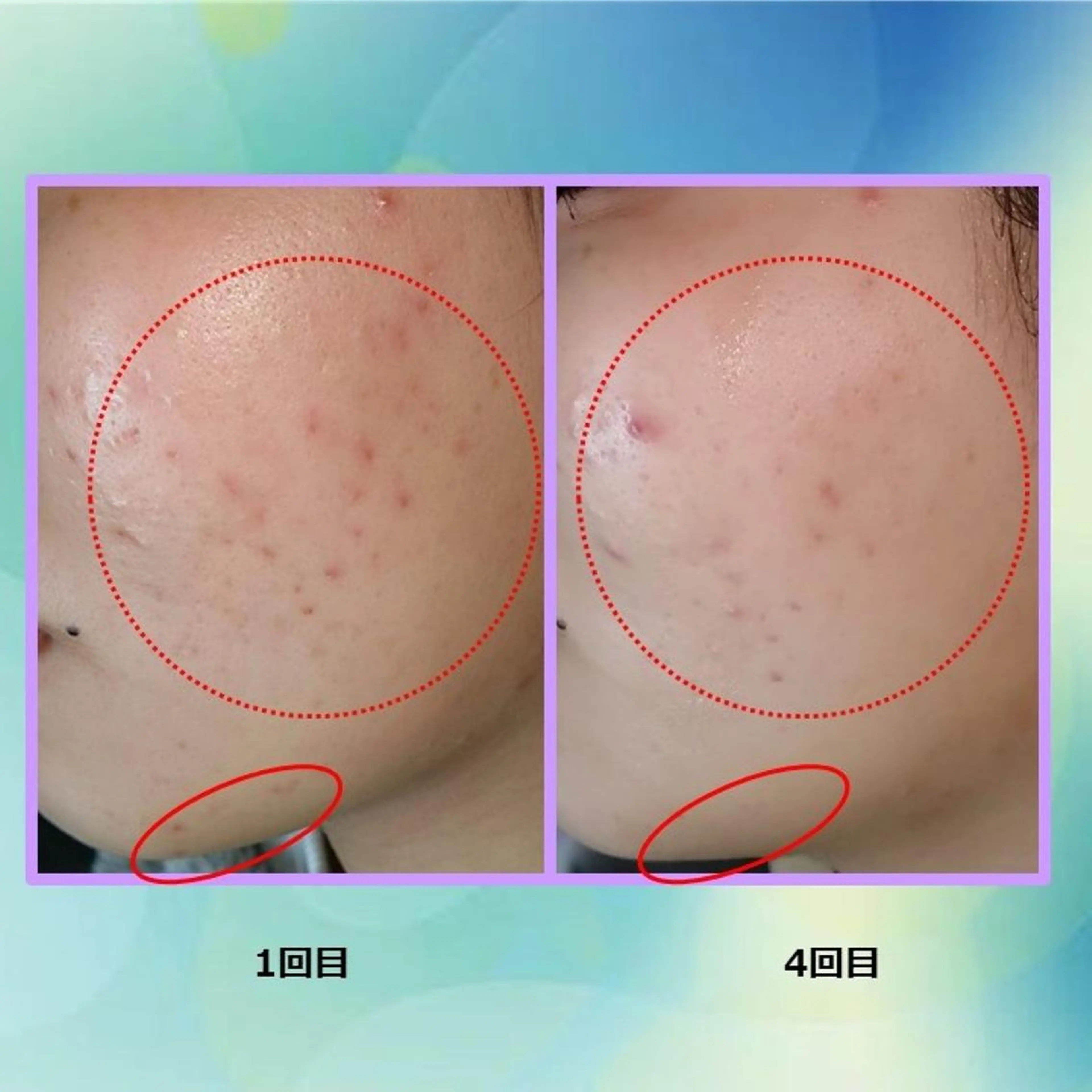 その他 ふじわら ひかりのその他イメージ