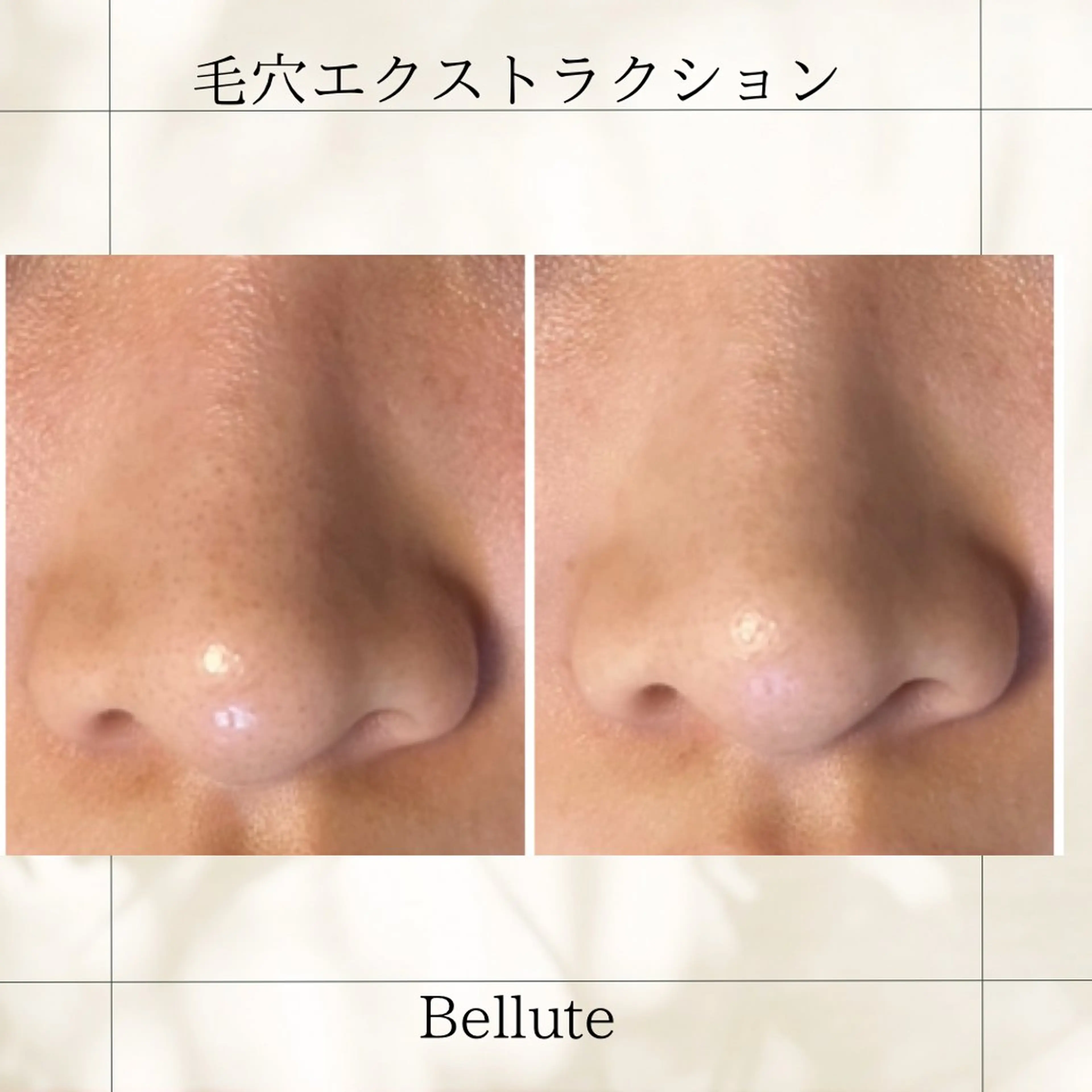 エステ リラク ピーリング専門店 Belluteのエステ・リラクイメージ