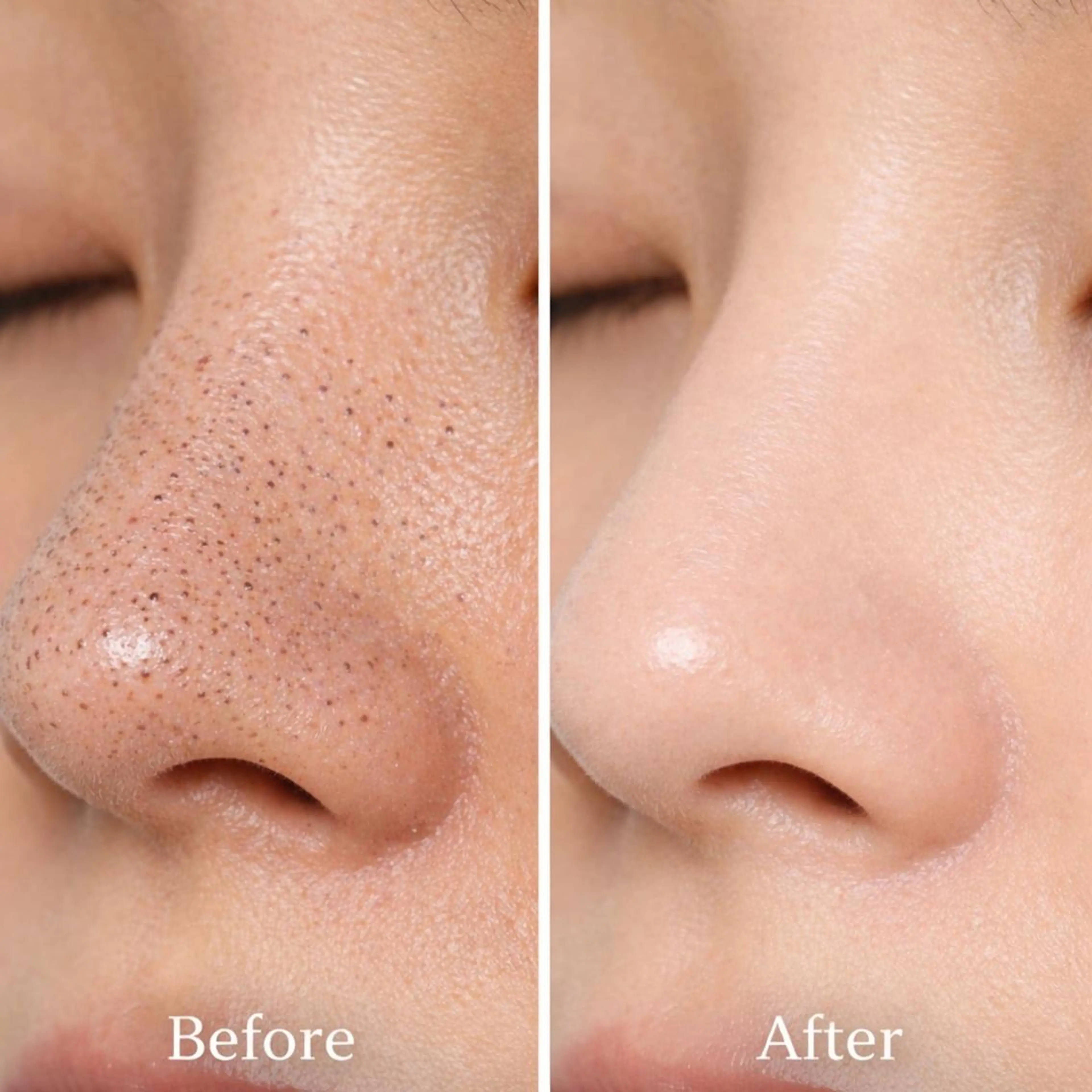 その他 脱毛×肌管理サロン ルネルのエステ・リラクイメージ