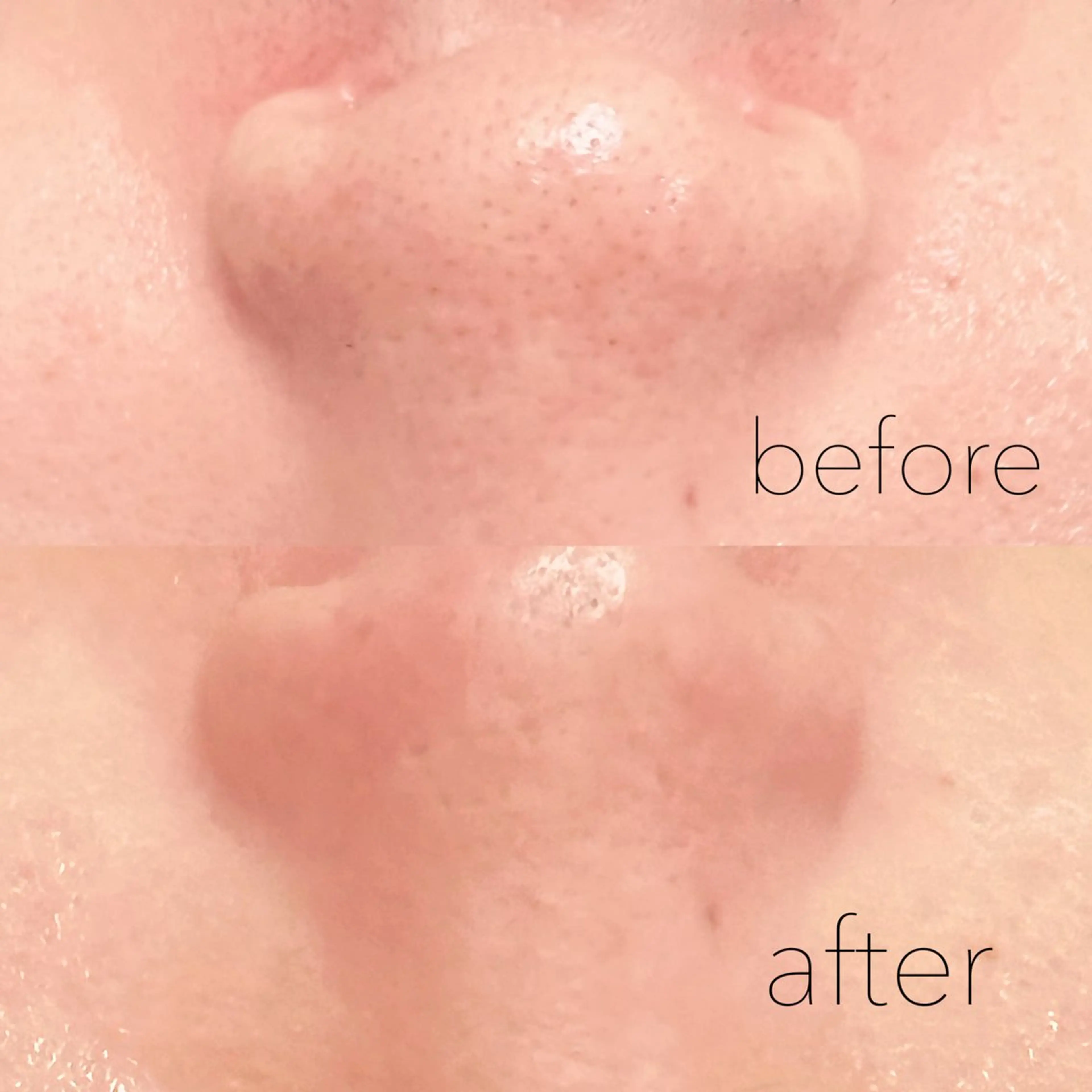 眉毛×肌質改善🫧 高岳/新栄町✨YUUの眉毛・アイブロウイメージ