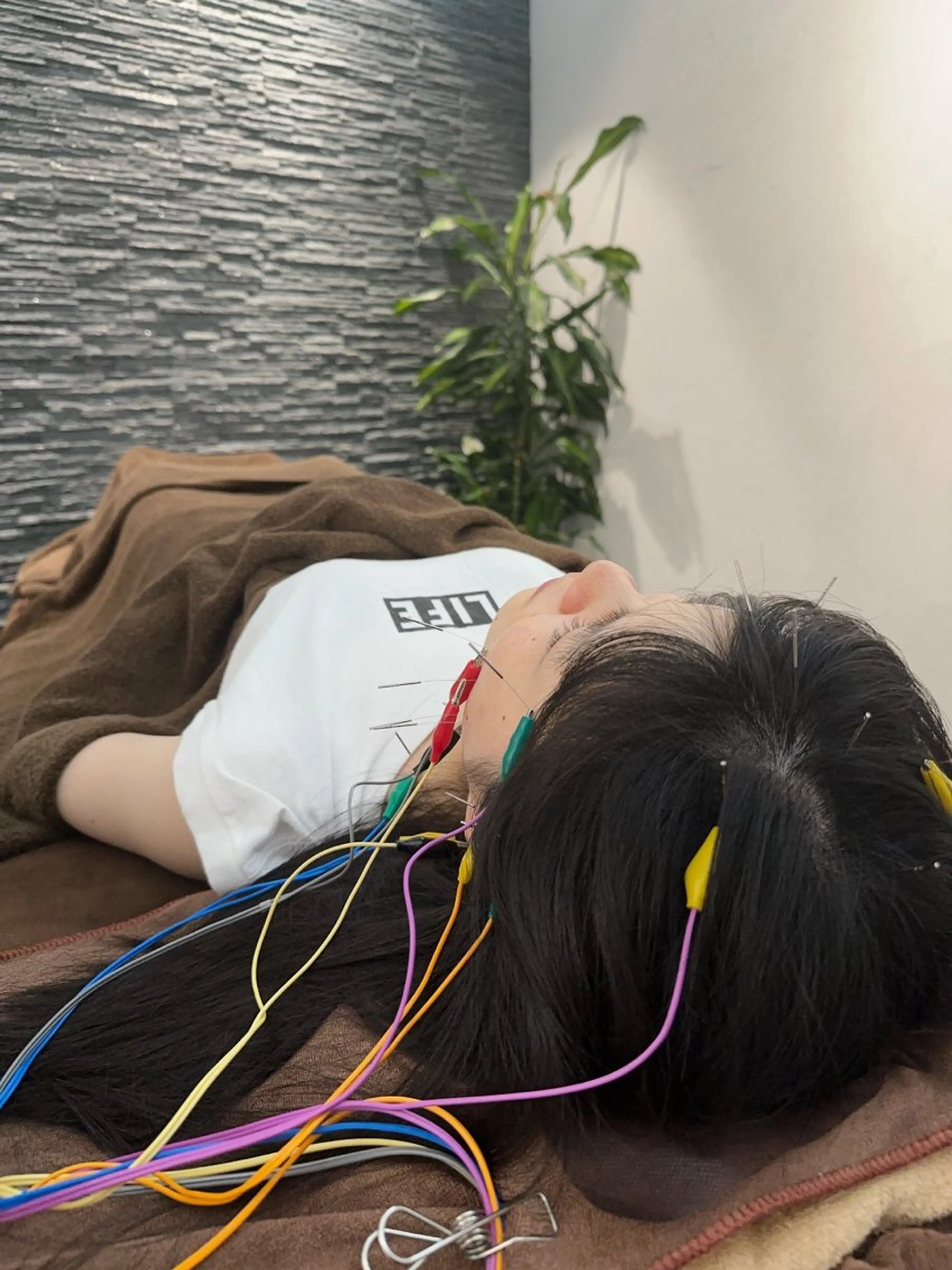 その他 美容鍼灸整体サロンBeauJu所属・小顔矯/美容鍼/鍼灸 BeauJuのその他イメージ